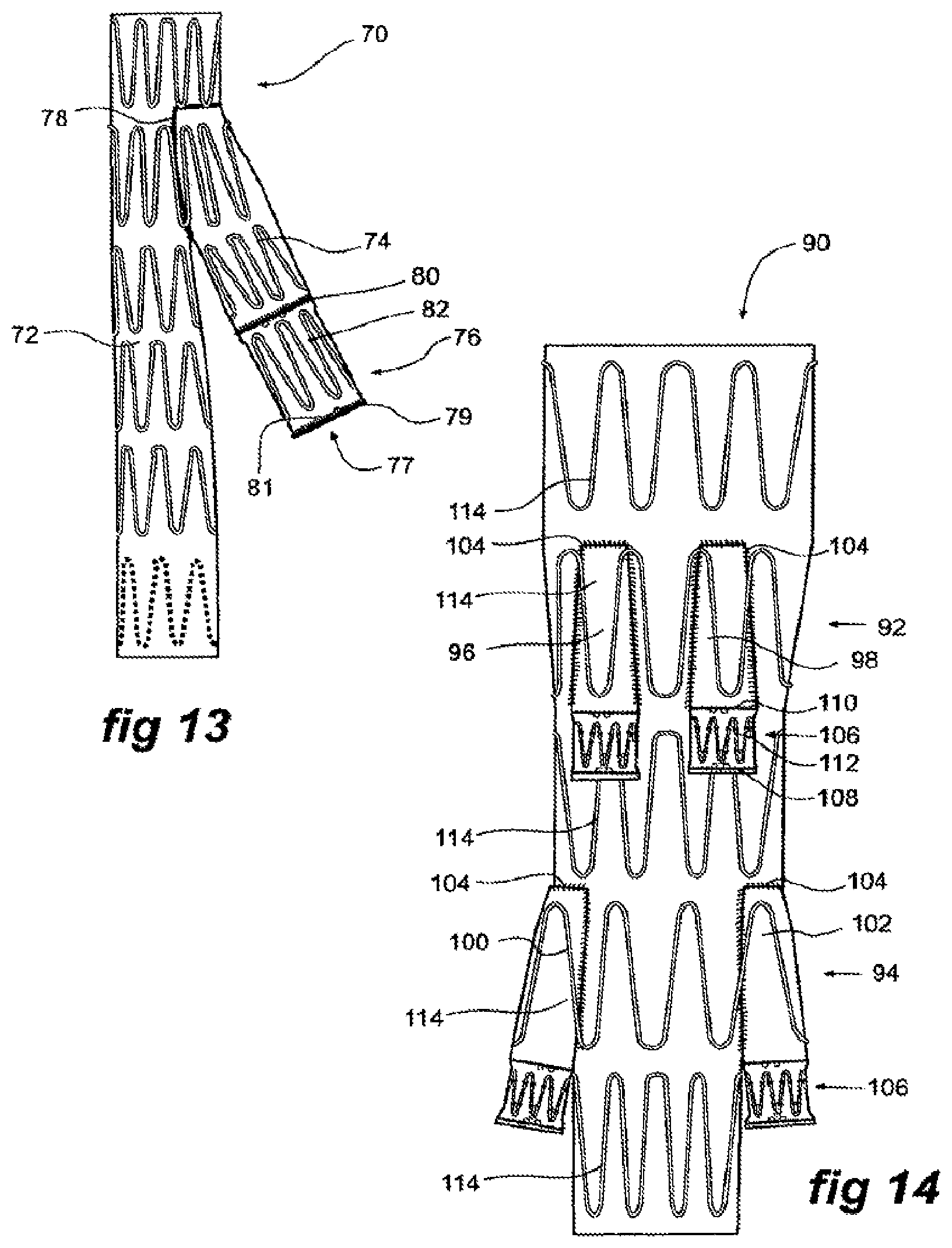 Patent US11771573 Figure 4 – Side branch stent graft