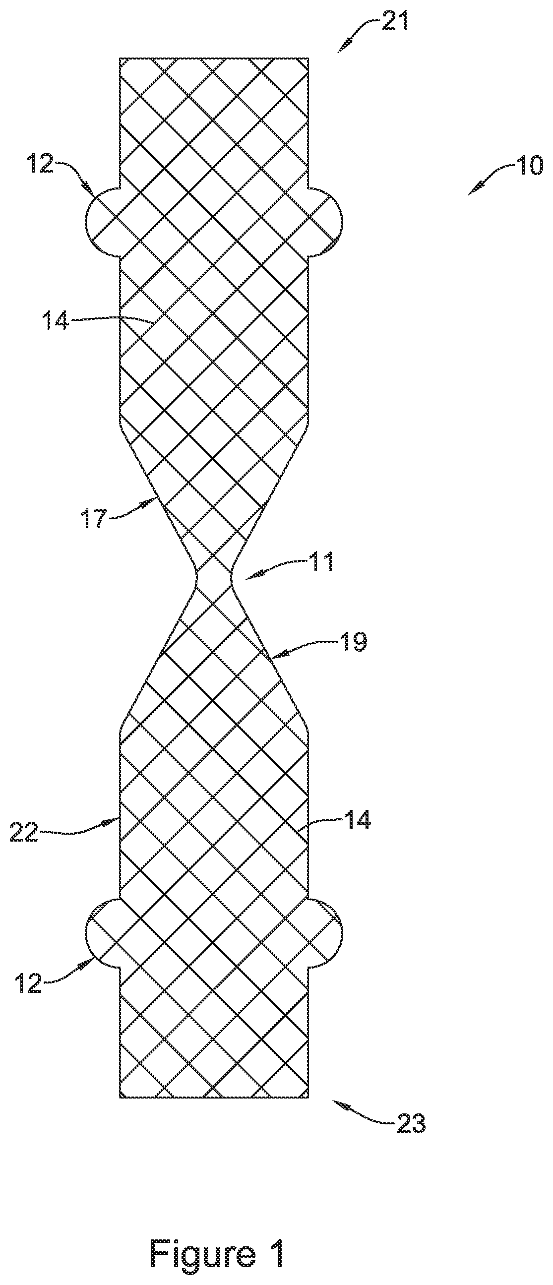 Patent US11771574 Figure 1 – Esophageal stent including a valve member