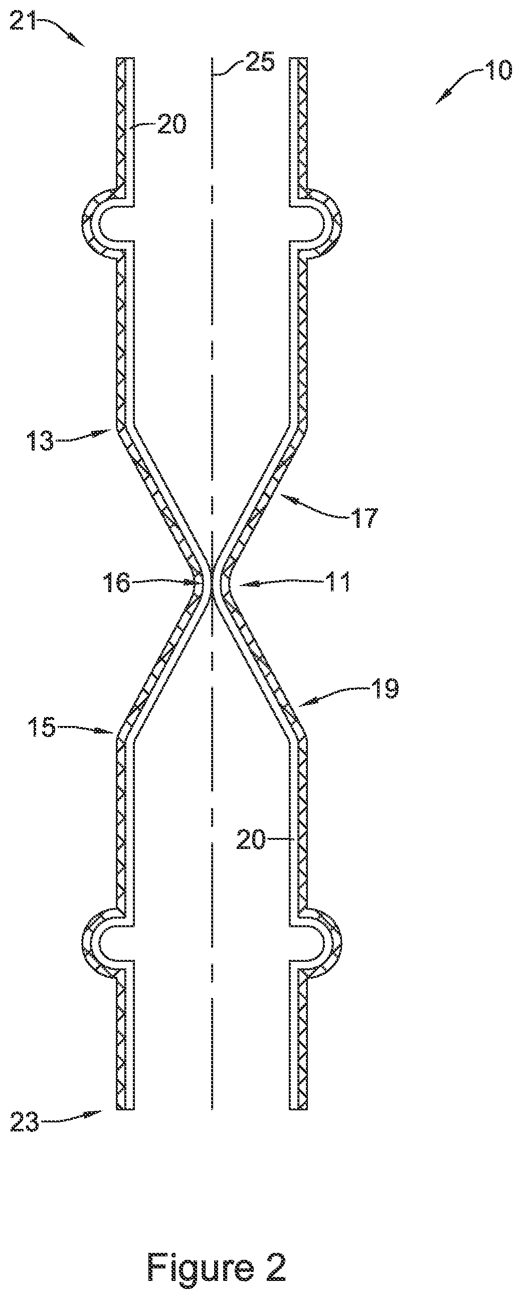 Patent US11771574 Figure 2 – Esophageal stent including a valve member