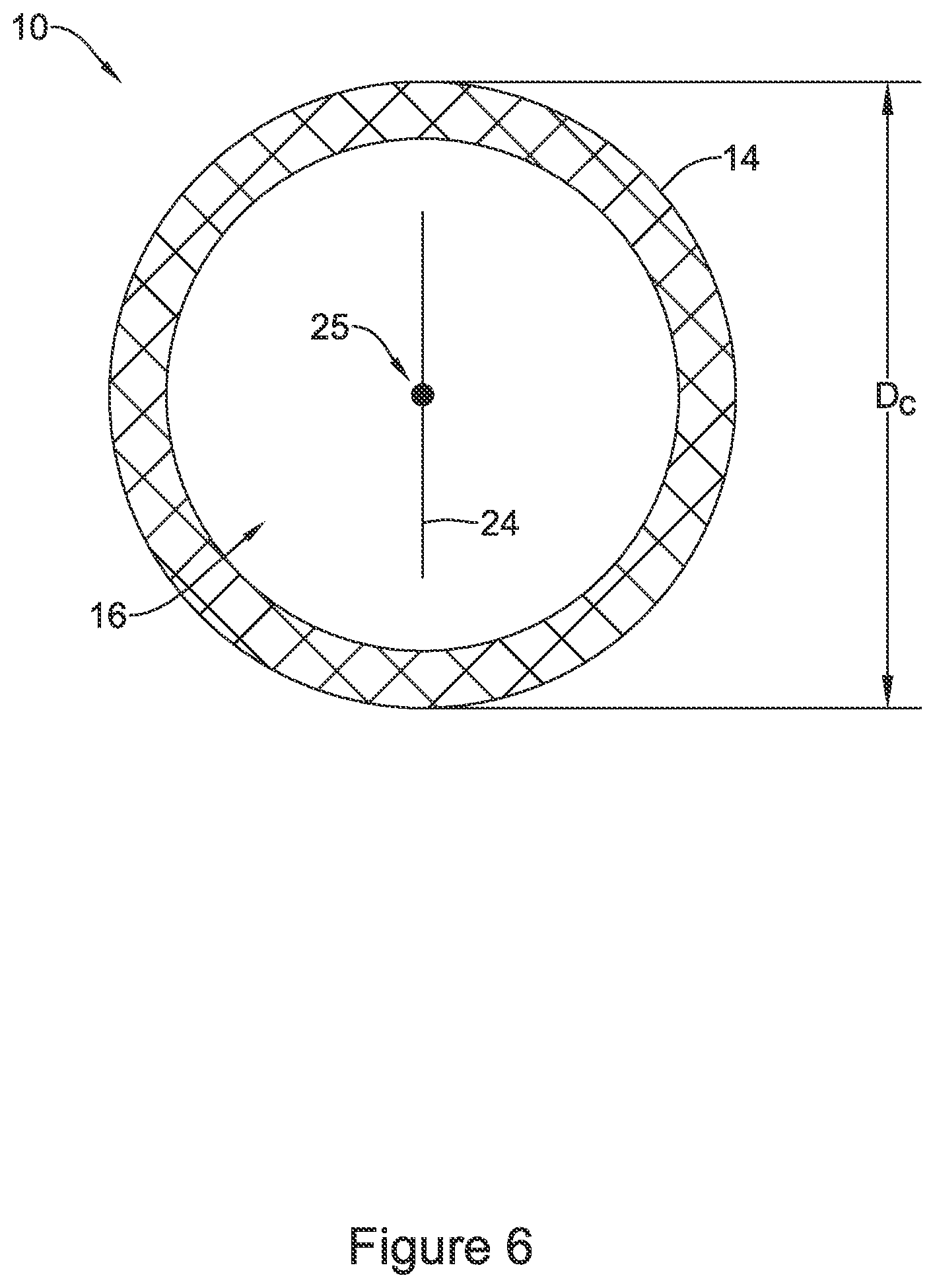 Patent US11771574 Figure 6 – Esophageal stent including a valve member