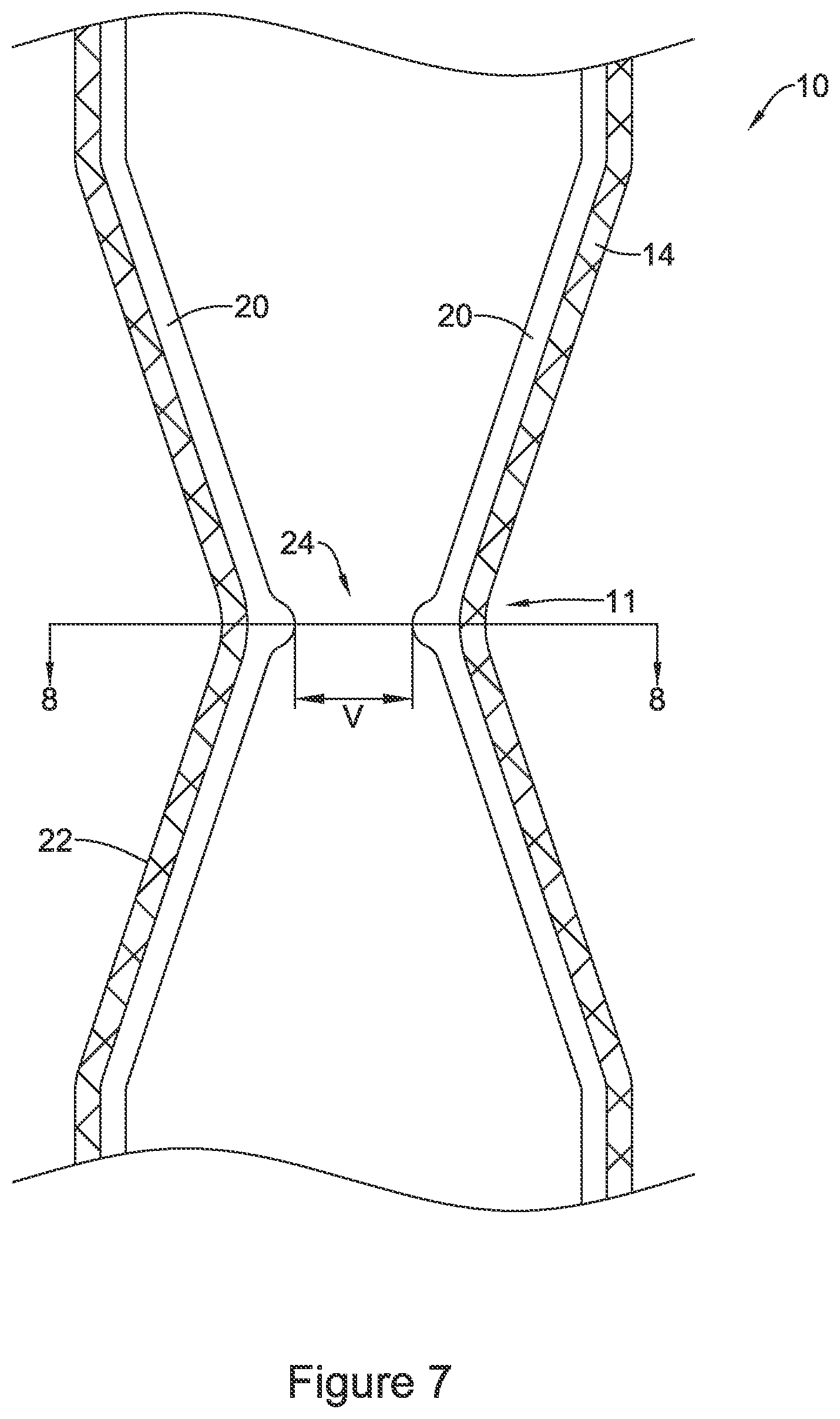 Patent US11771574 Figure 7 – Esophageal stent including a valve member