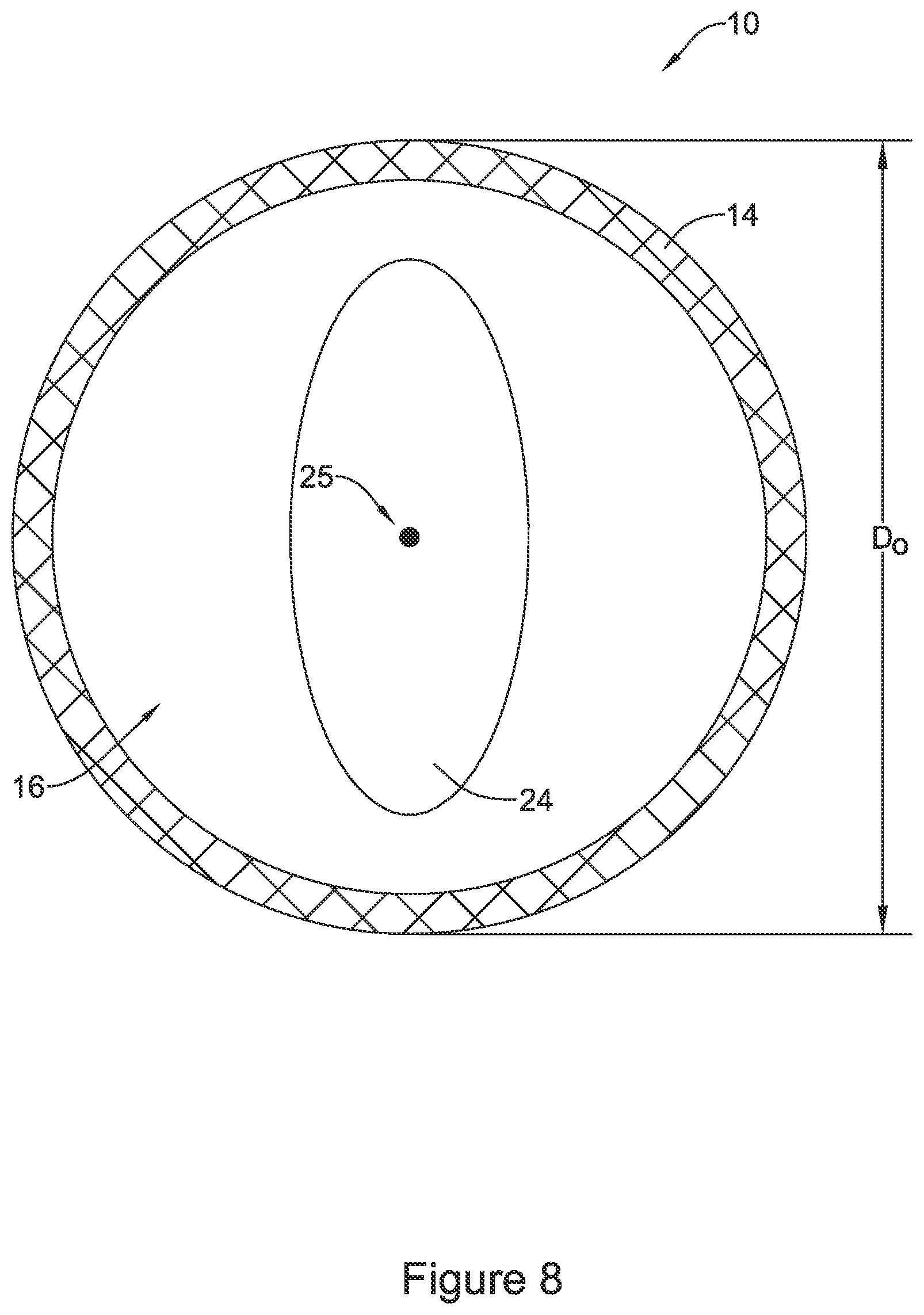 Patent US11771574 Figure 8 – Esophageal stent including a valve member