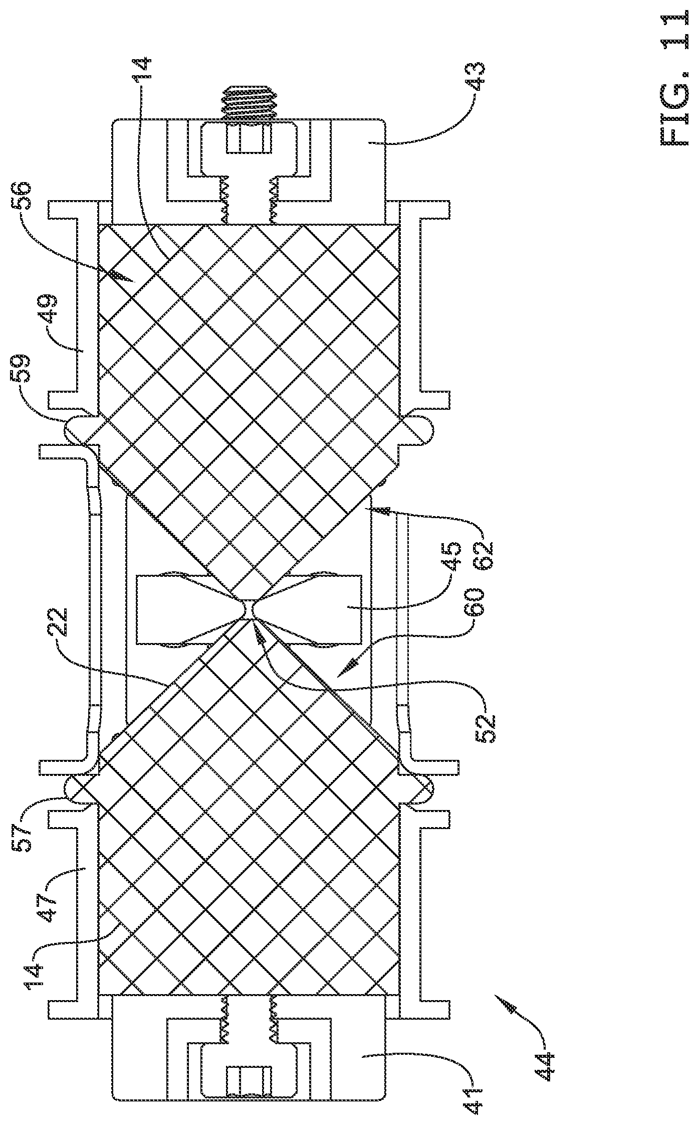 Patent US11771574 Figure 11 – Esophageal stent including a valve member