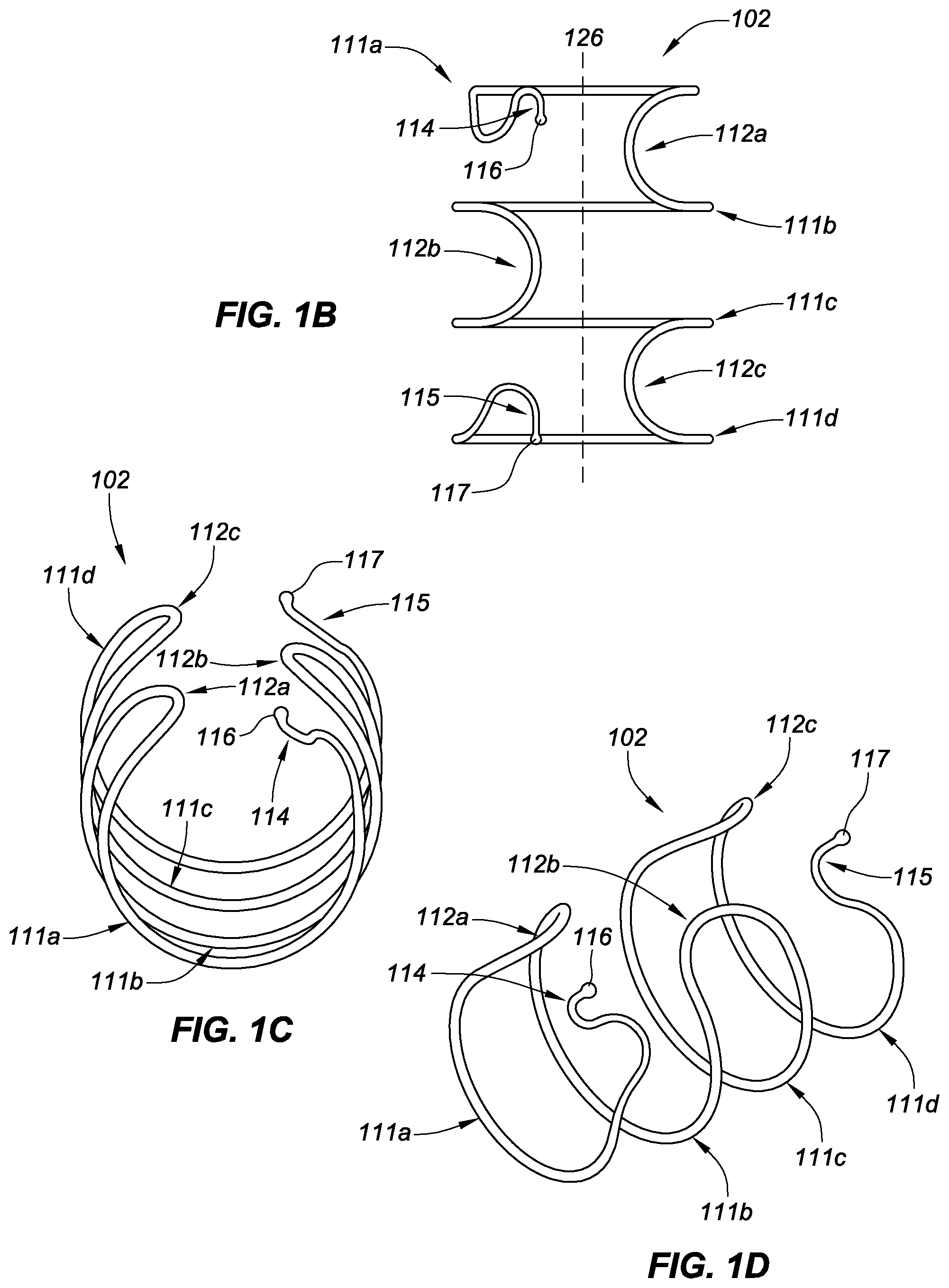 Patent US11771575 Figure 2 – Systems, devices, and methods for the accurate deployment and imaging of an implant in the prostatic urethra