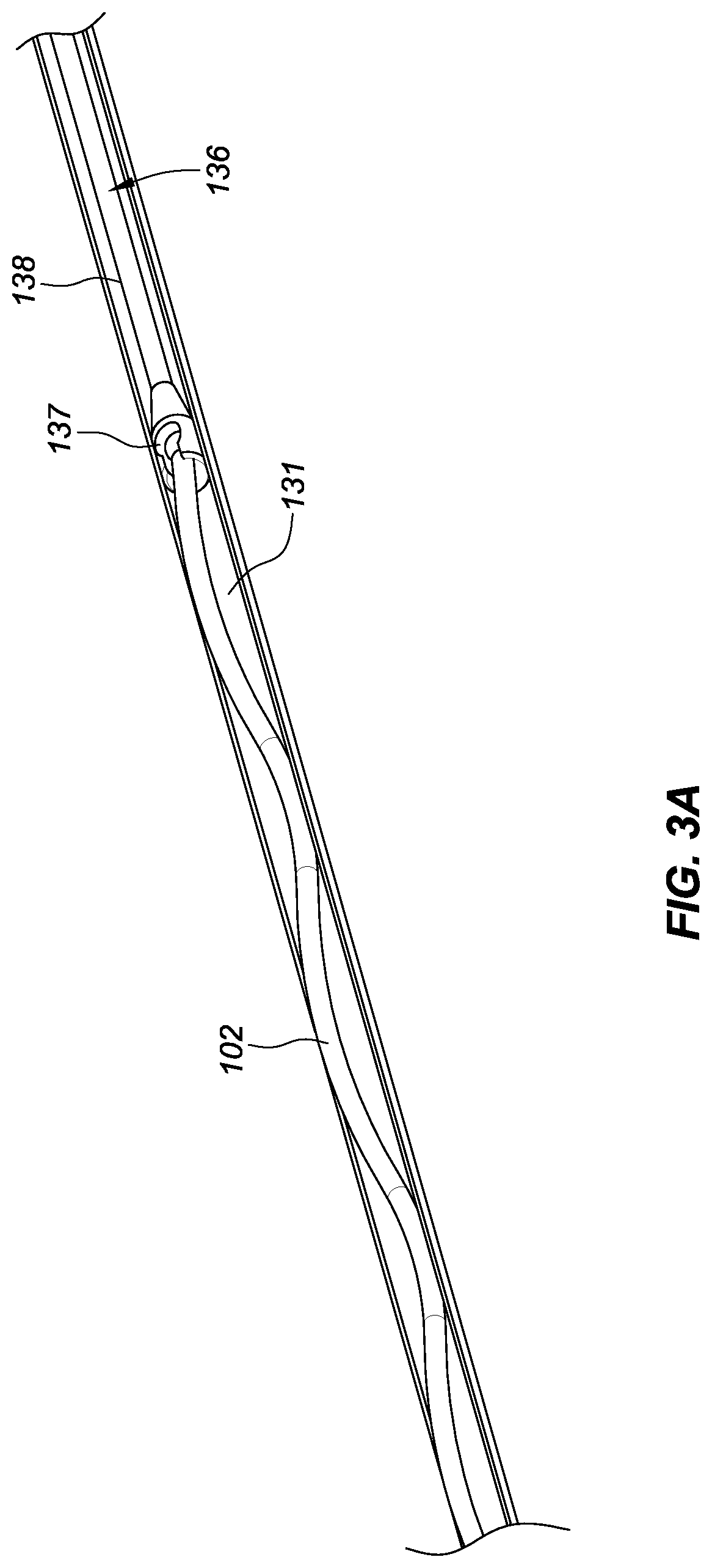 Patent US11771575 Figure 7 – Systems, devices, and methods for the accurate deployment and imaging of an implant in the prostatic urethra