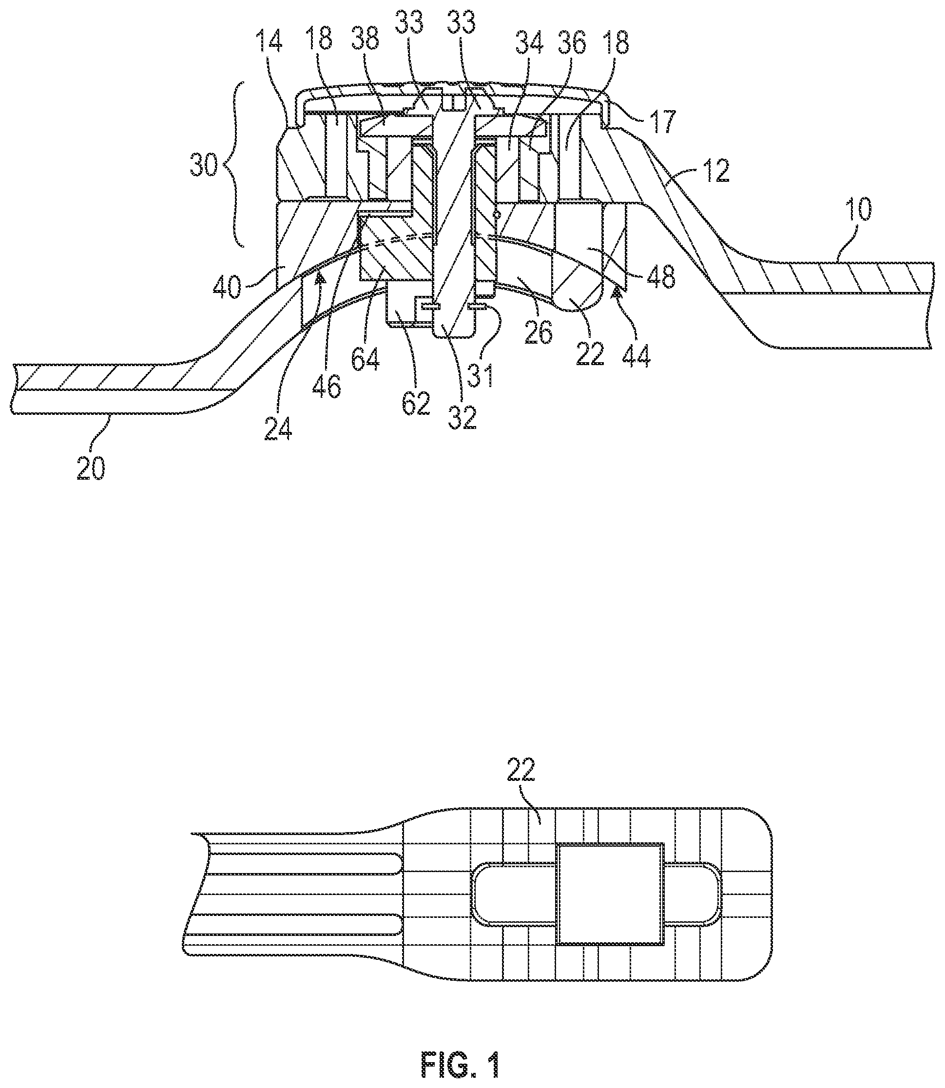 Patent US11771576 Figure 1 – Tiltable articulated joint brace