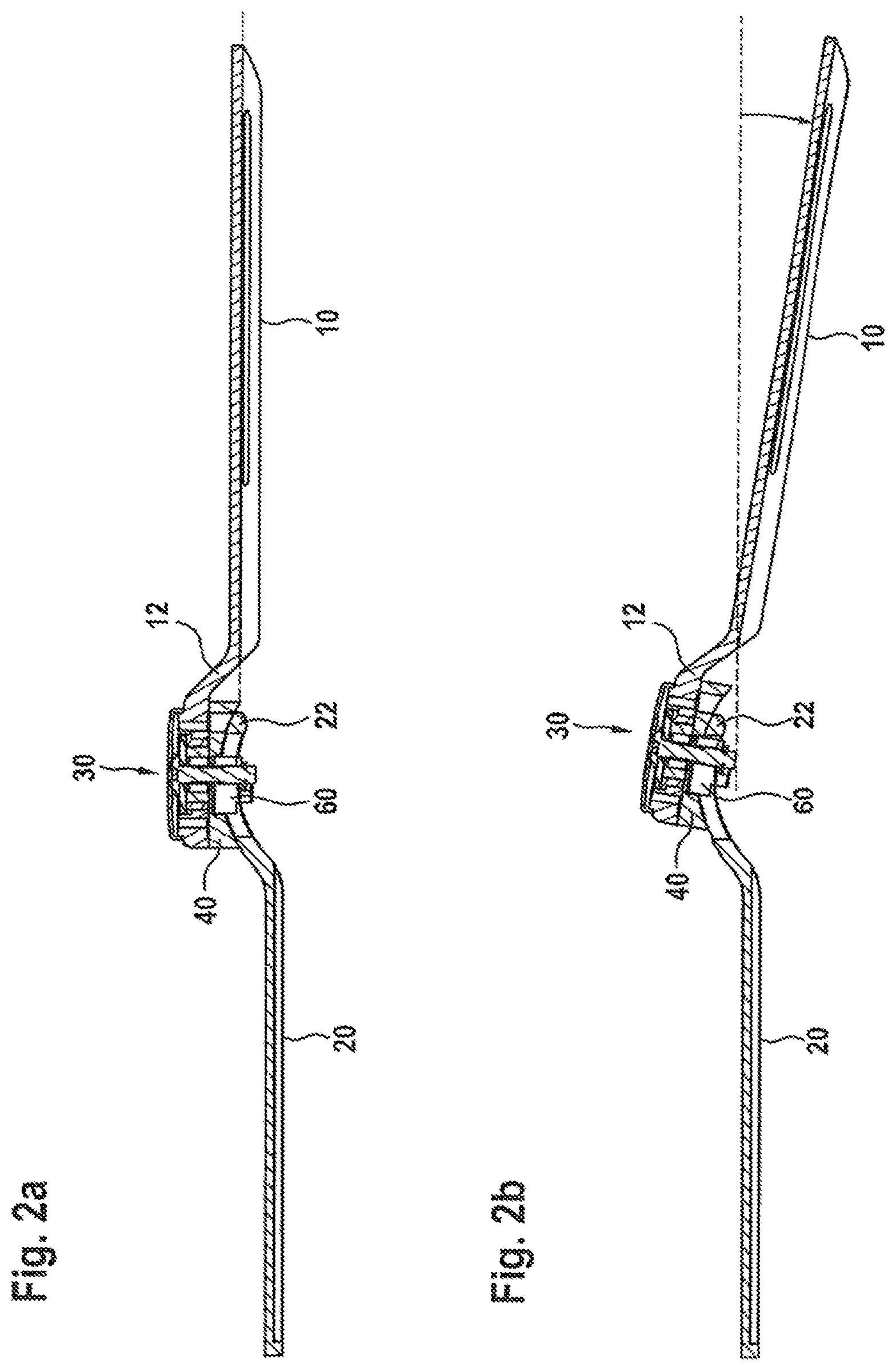 Patent US11771576 Figure 2 – Tiltable articulated joint brace