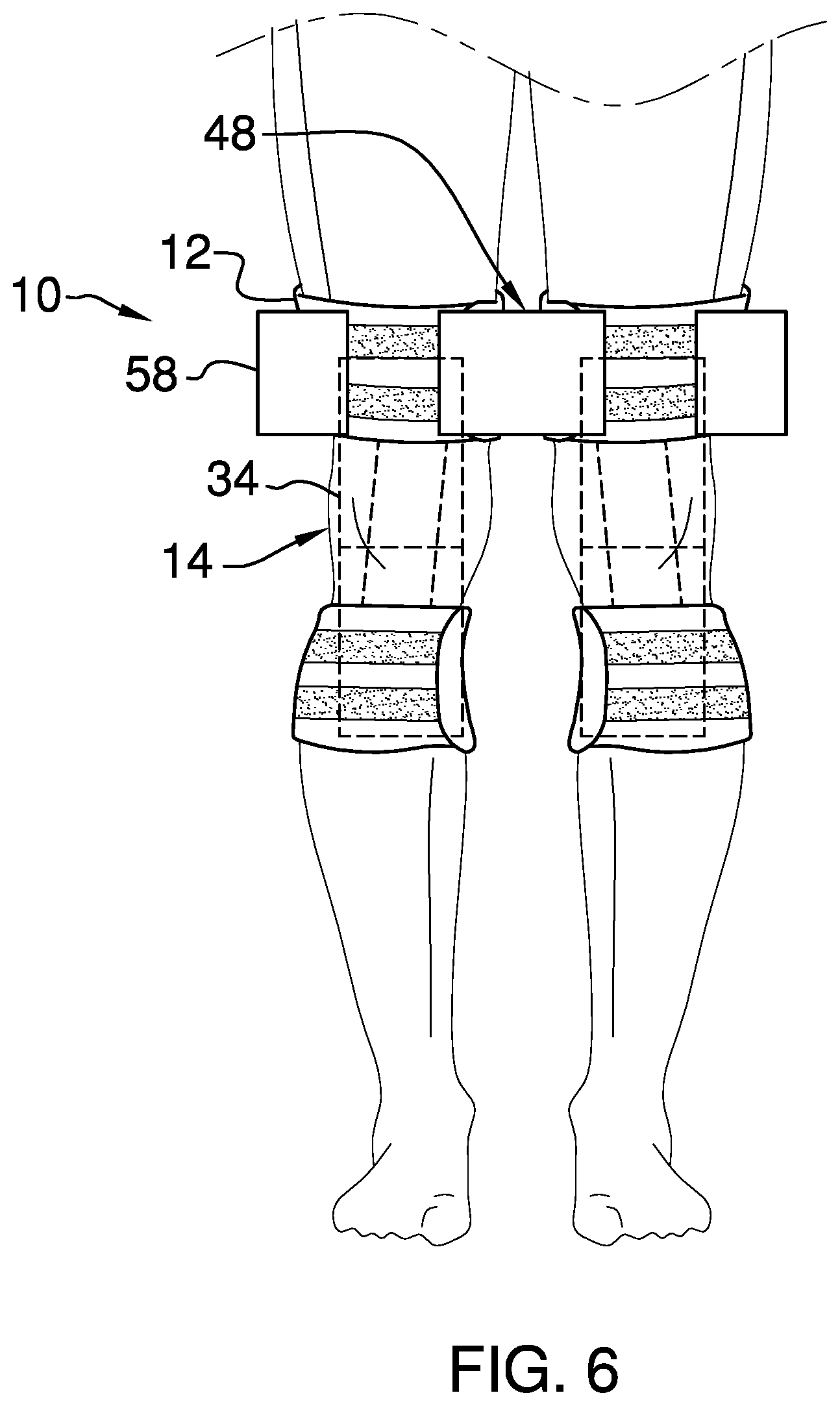 Patent US11771577 Figure 3 – Modular knee brace assembly