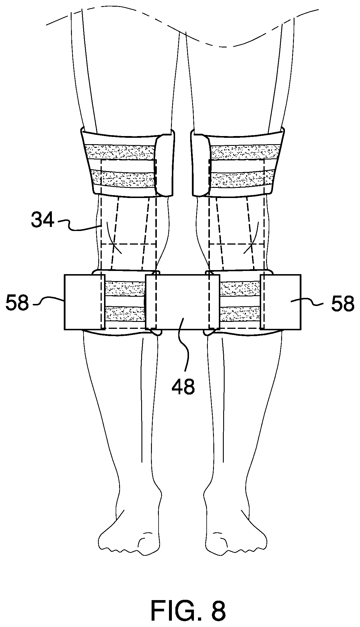 Patent US11771577 Figure 5 – Modular knee brace assembly