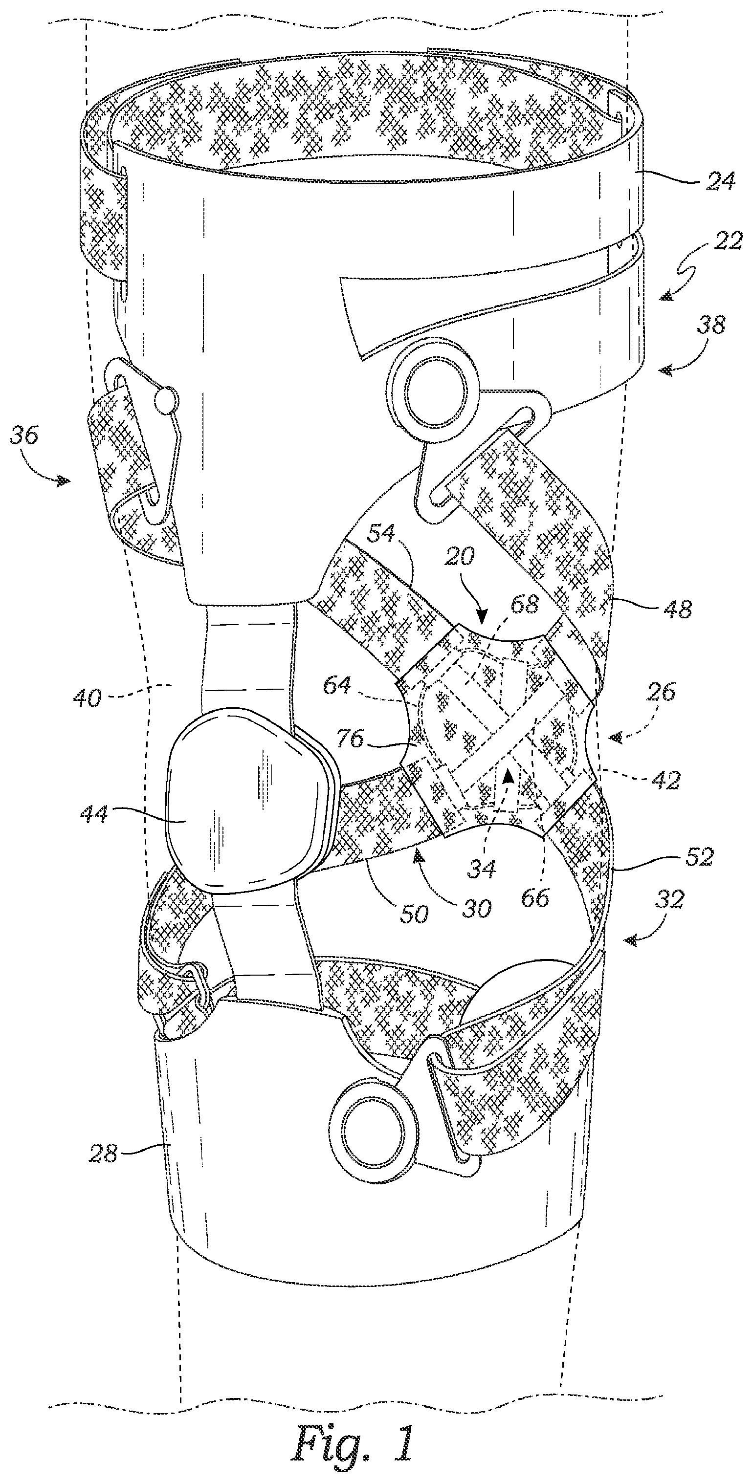 Patent US11771578 Figure 1 – Cross-strap tensioning apparatus for osteoarthritis braces