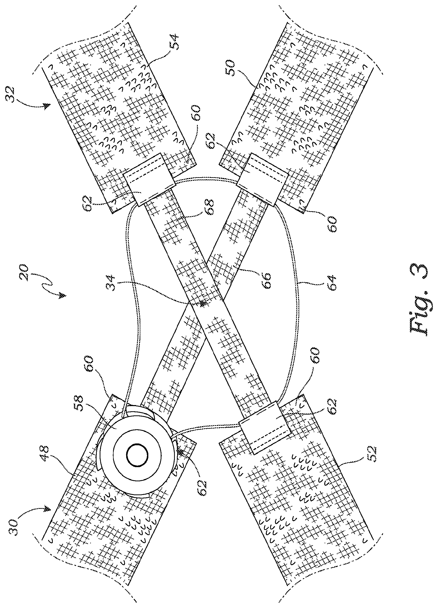 Patent US11771578 Figure 3 – Cross-strap tensioning apparatus for osteoarthritis braces