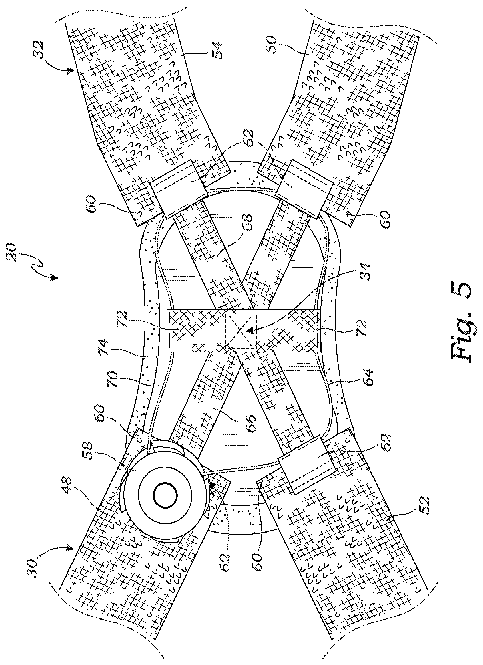 Patent US11771578 Figure 5 – Cross-strap tensioning apparatus for osteoarthritis braces