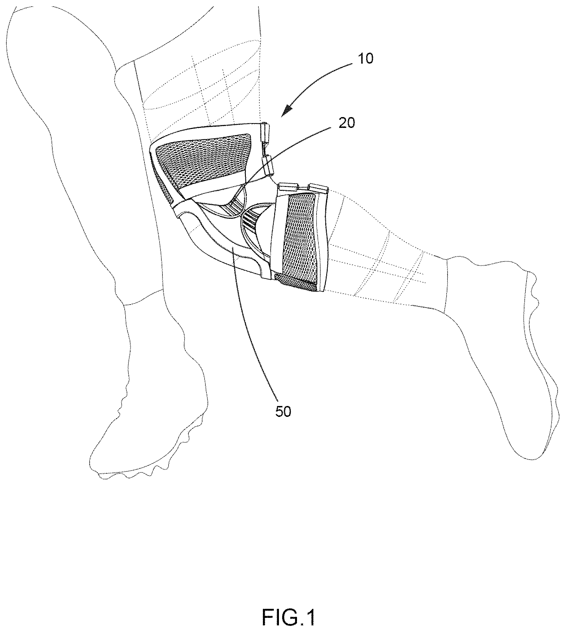 Patent US11771579 Figure 1 – Protective support for joints and extremities