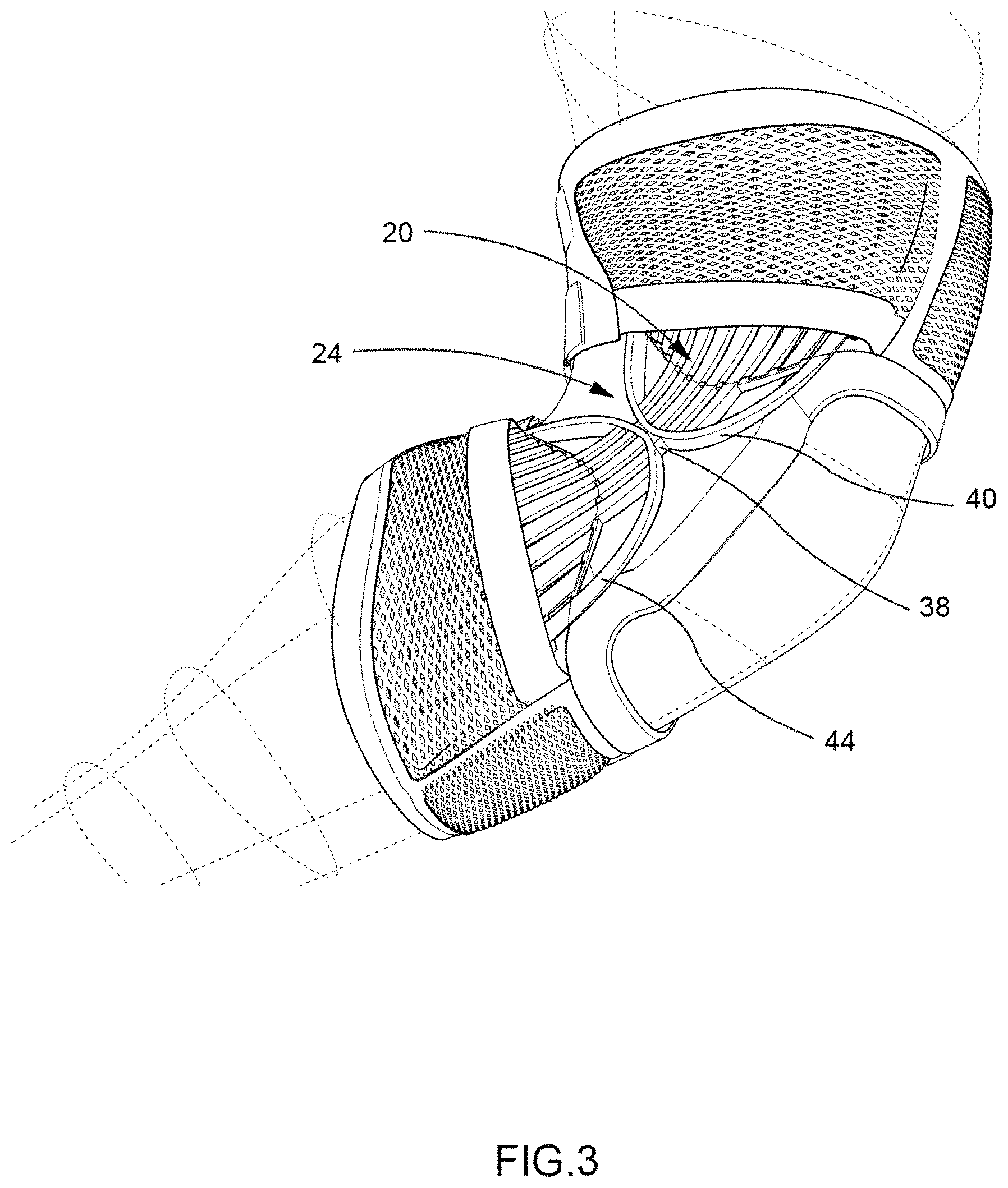 Patent US11771579 Figure 3 – Protective support for joints and extremities