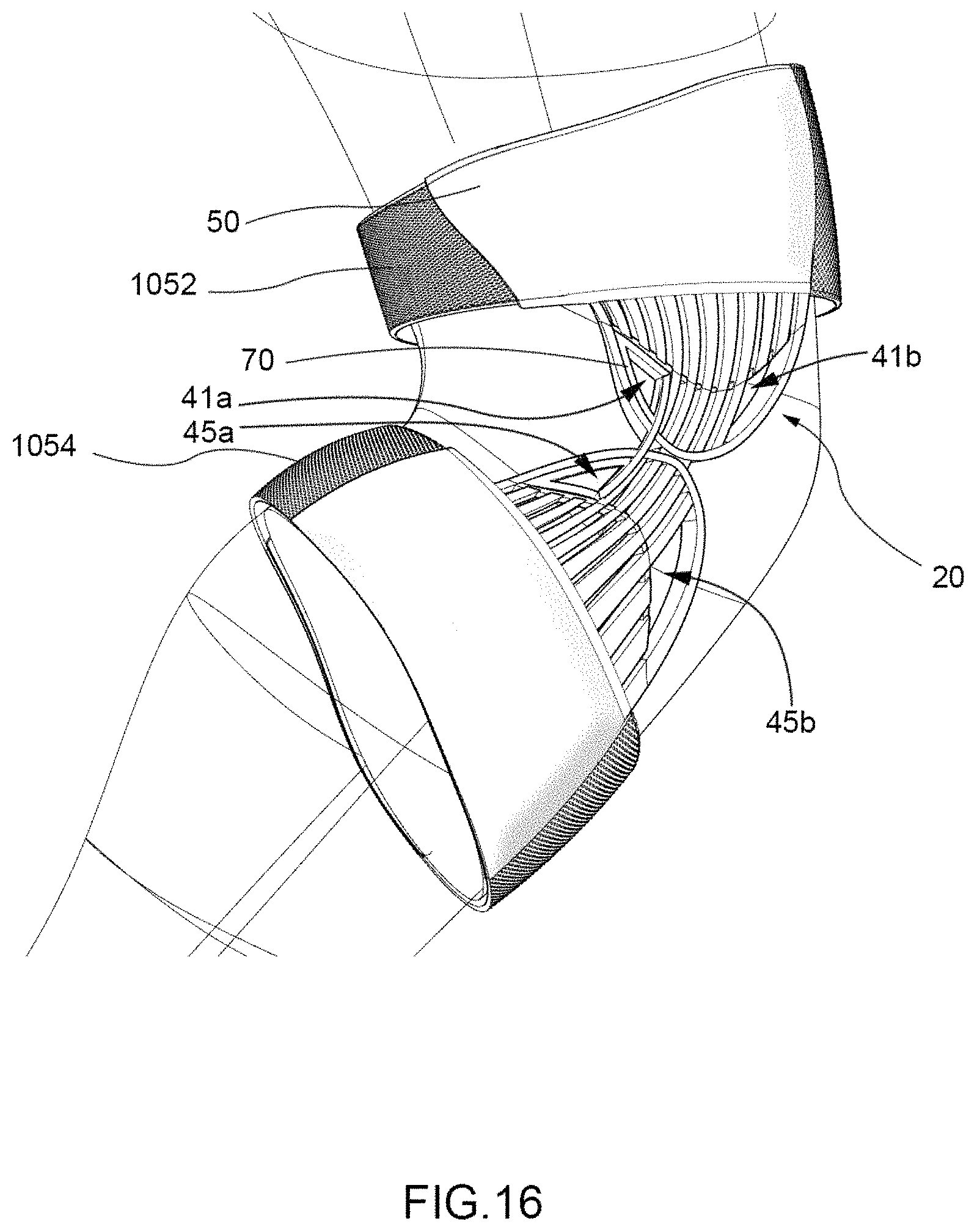 Patent US11771579 Figure 18 – Protective support for joints and extremities