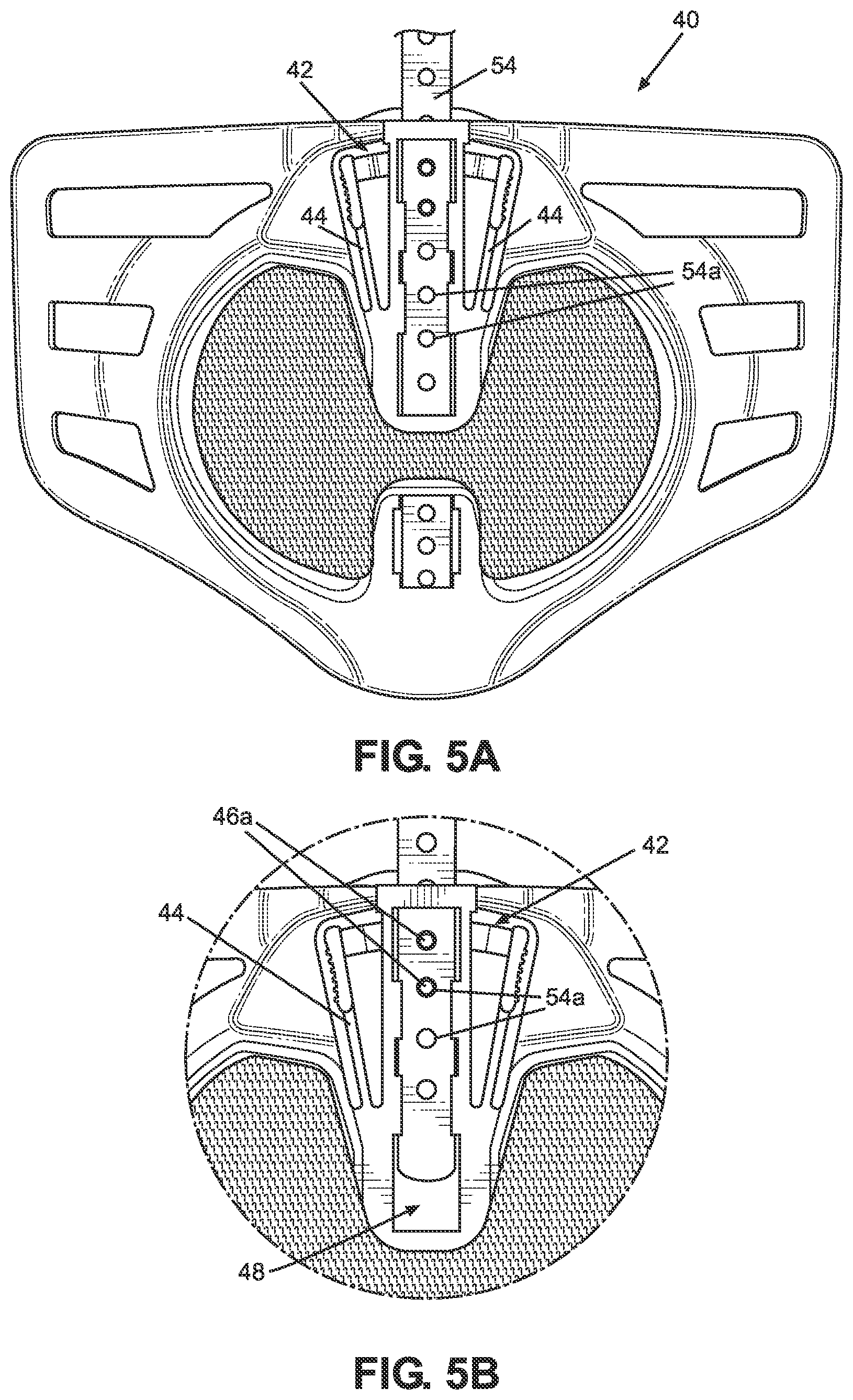 Patent US11771580 Figure 3 – TLSO/LSO spine brace