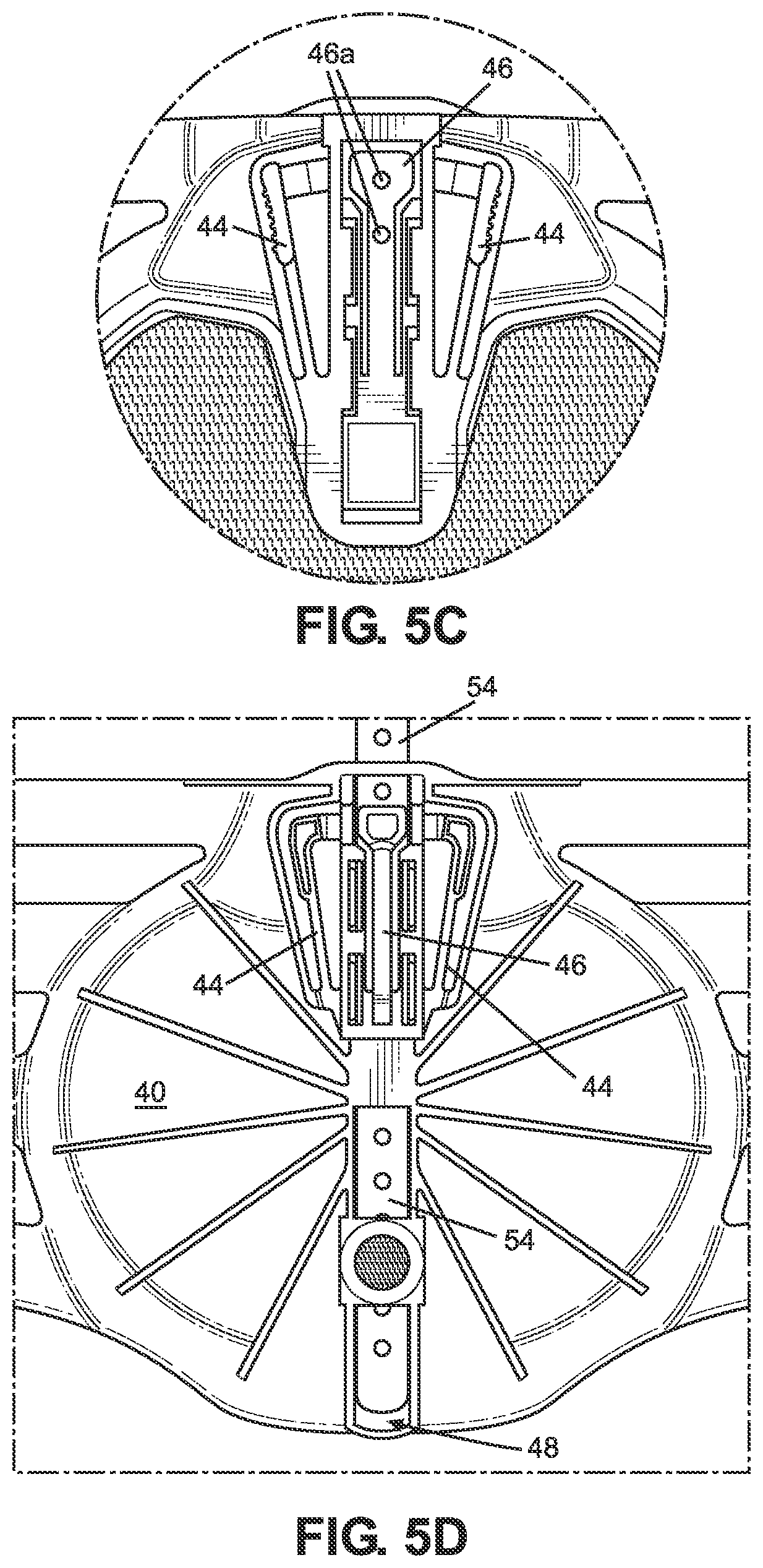 Patent US11771580 Figure 4 – TLSO/LSO spine brace