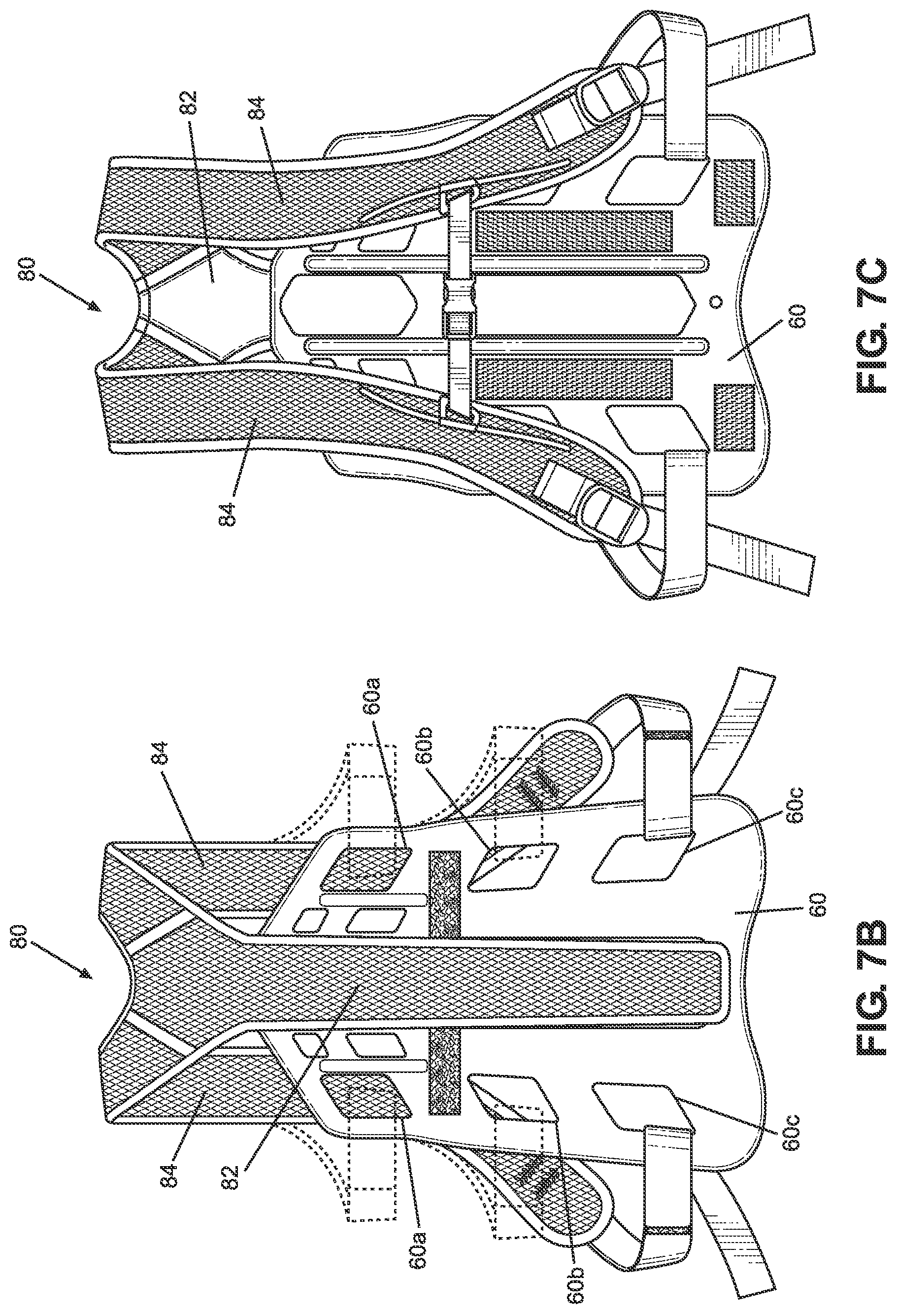 Patent US11771580 Figure 7 – TLSO/LSO spine brace