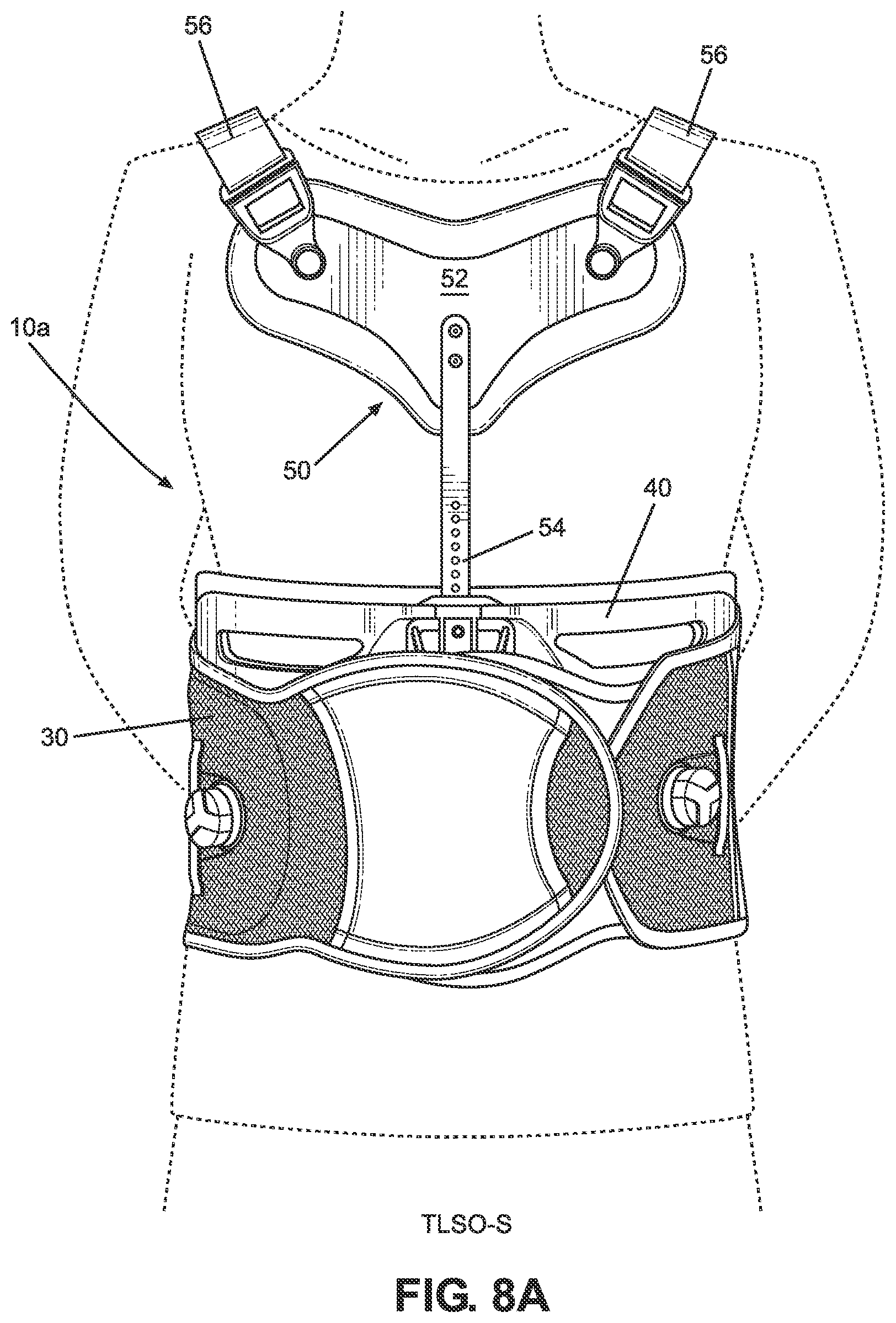 Patent US11771580 Figure 8 – TLSO/LSO spine brace