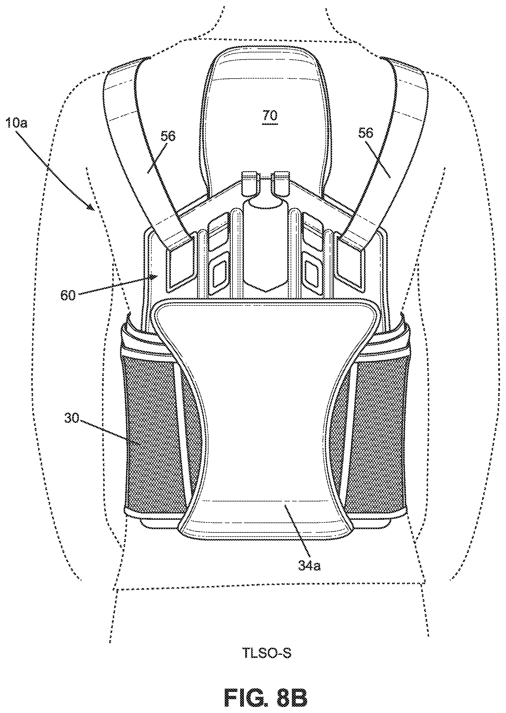 Patent US11771580 Figure 9 – TLSO/LSO spine brace