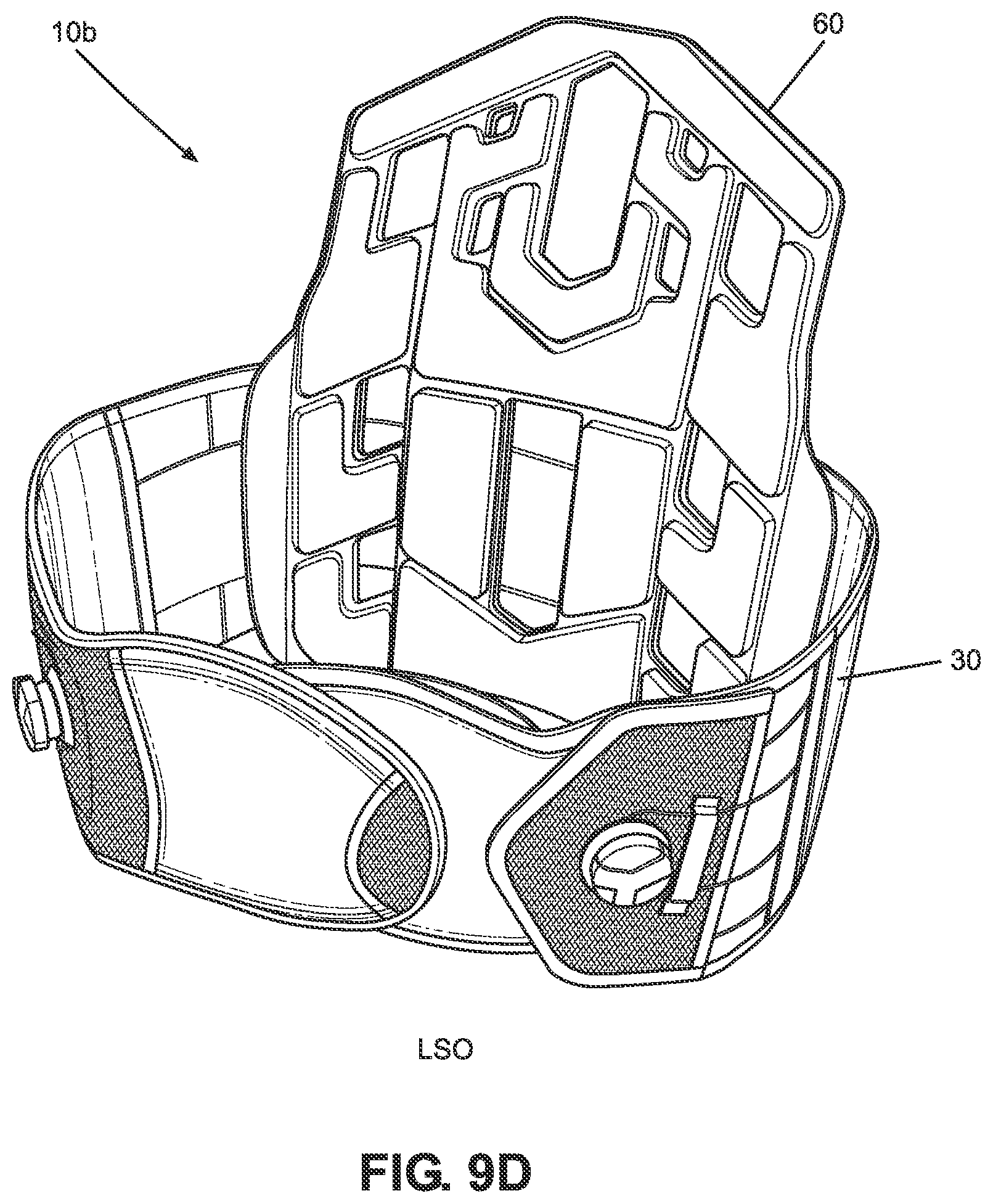 Patent US11771580 Figure 15 – TLSO/LSO spine brace