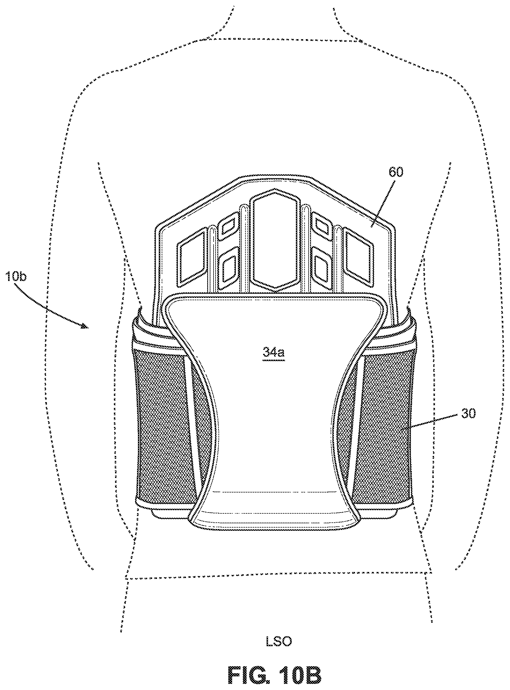 Patent US11771580 Figure 17 – TLSO/LSO spine brace