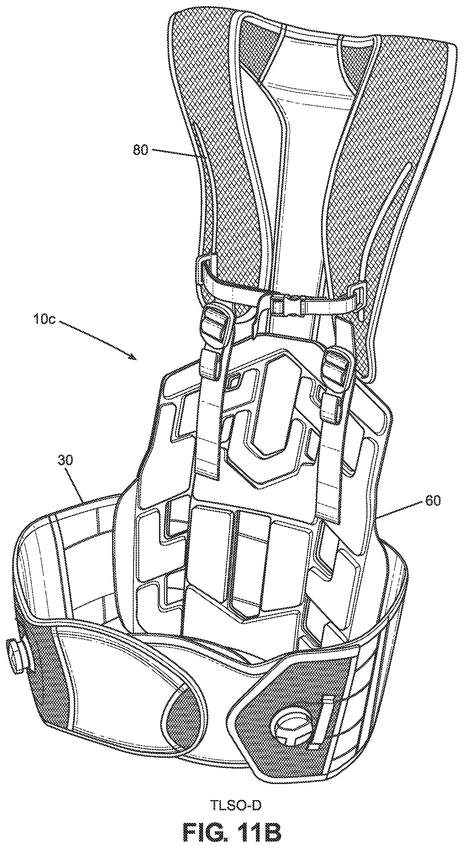 Patent US11771580 Figure 20 – TLSO/LSO spine brace