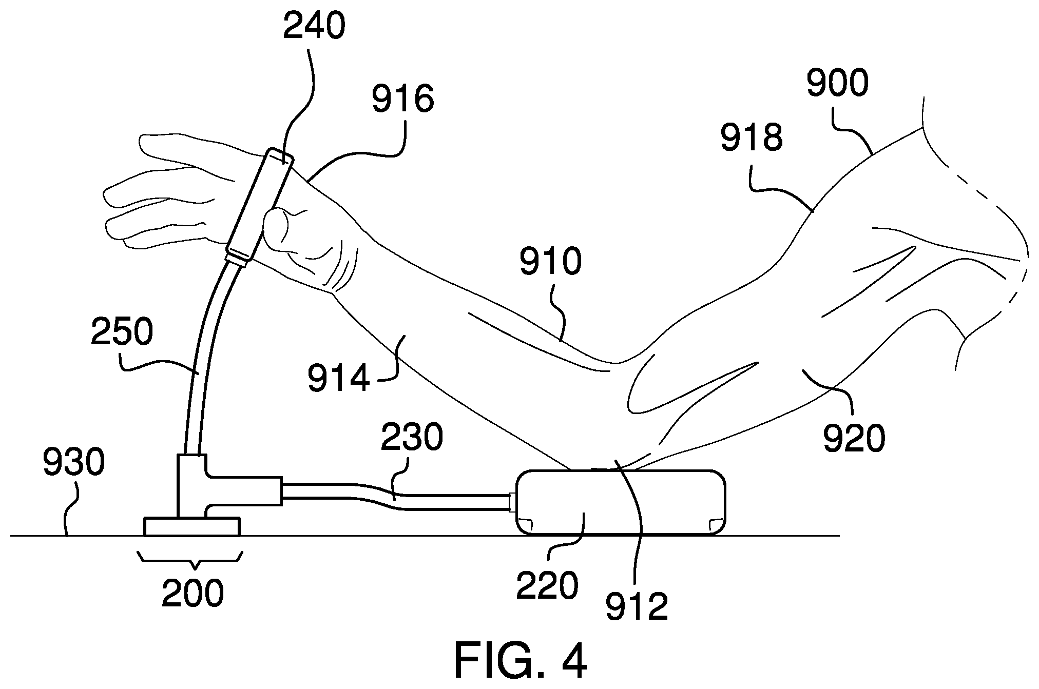 Patent US11771583 Figure 4 – Arm-casting stand