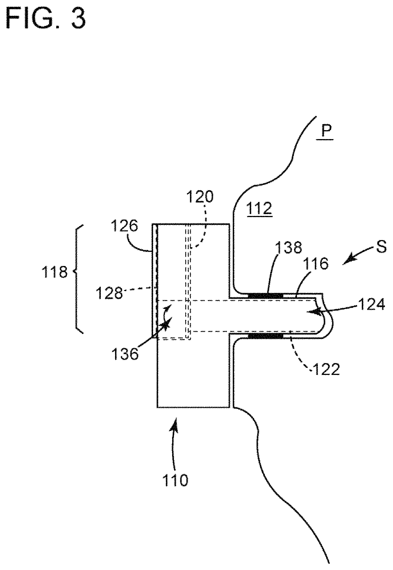 Patent US11771585 Figure 3 – Devices, systems and methods for regulating flow from a stoma on a patient