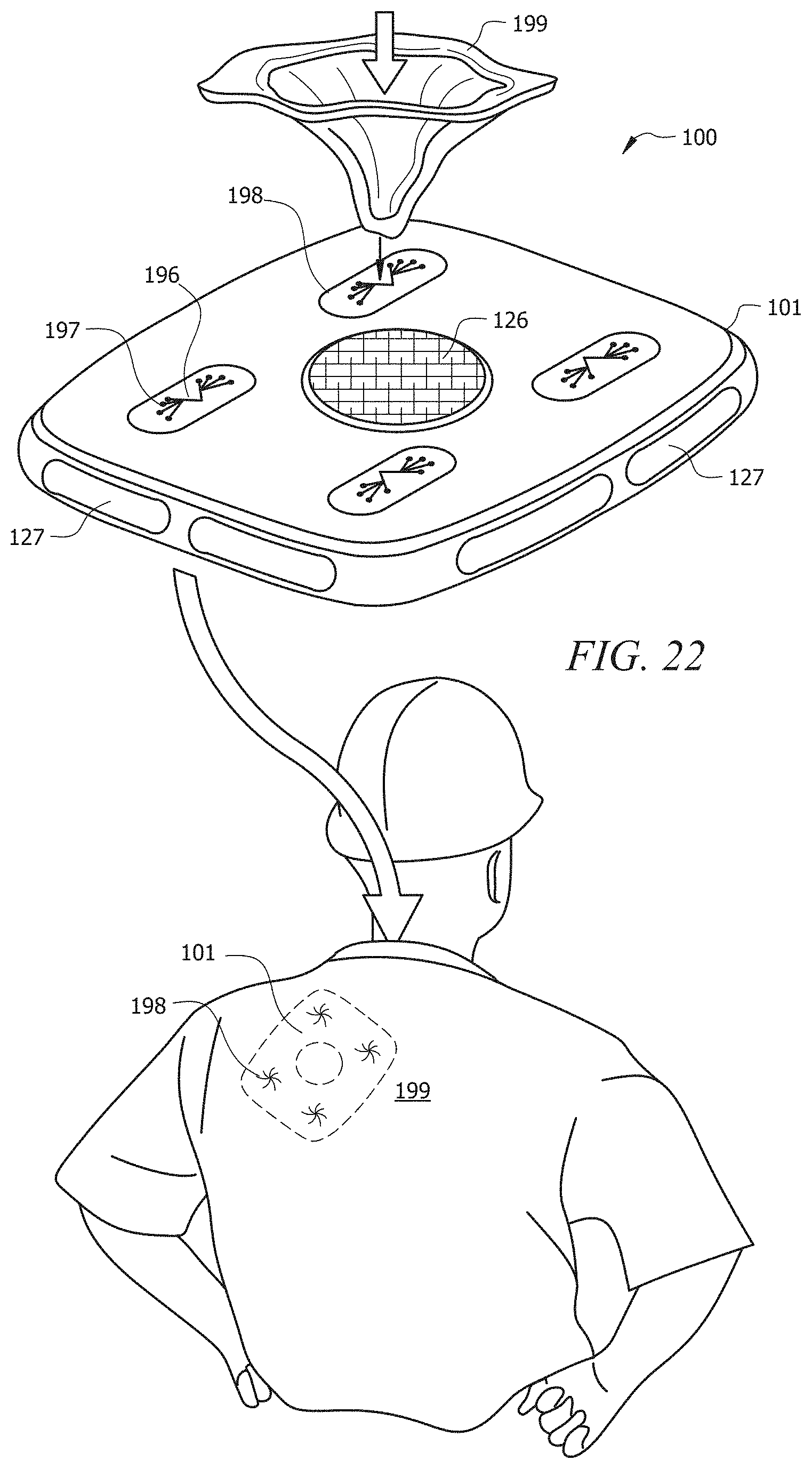Patent US11771587 Figure 19 – Portable rechargeable therapy pods
