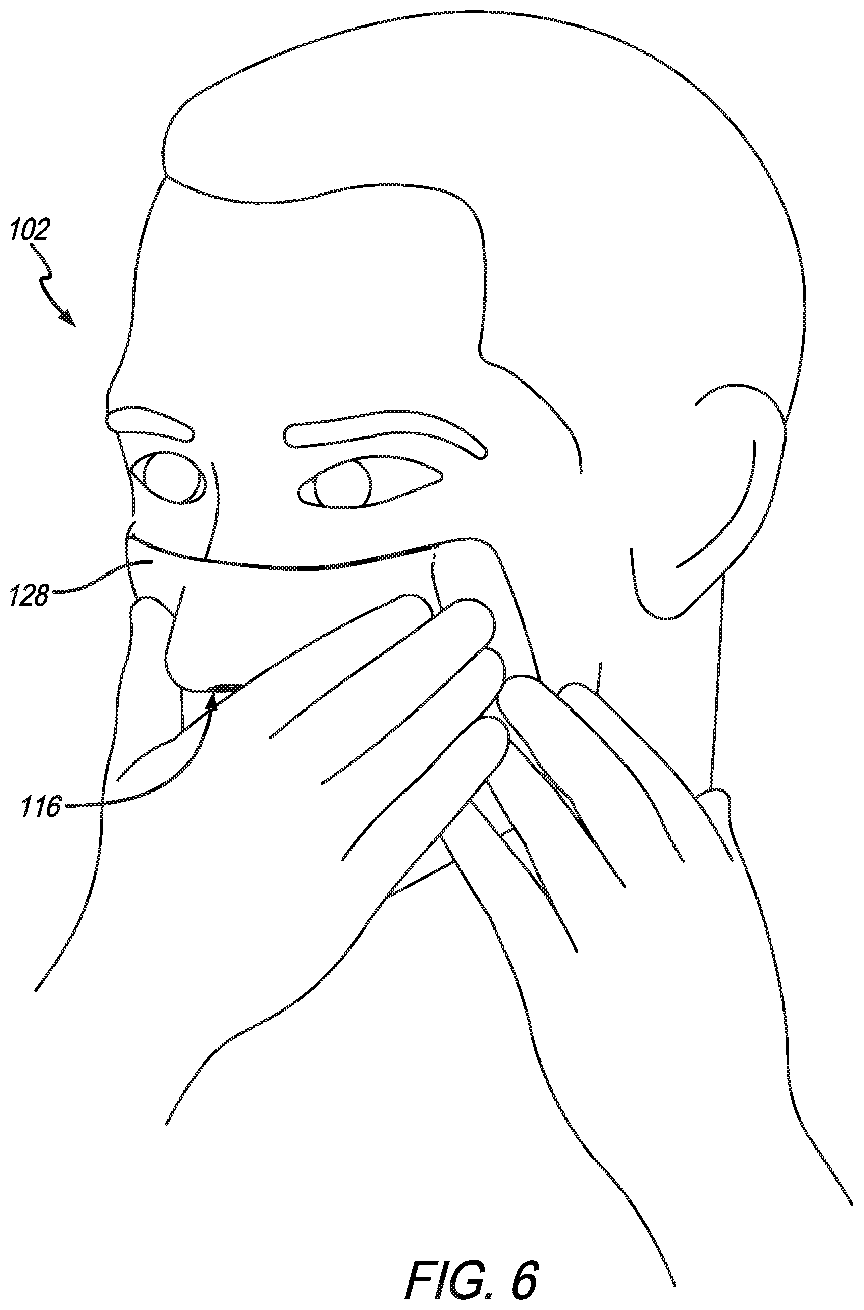 Patent US11771589 Figure 6 – Molded cooling and heating face mask
