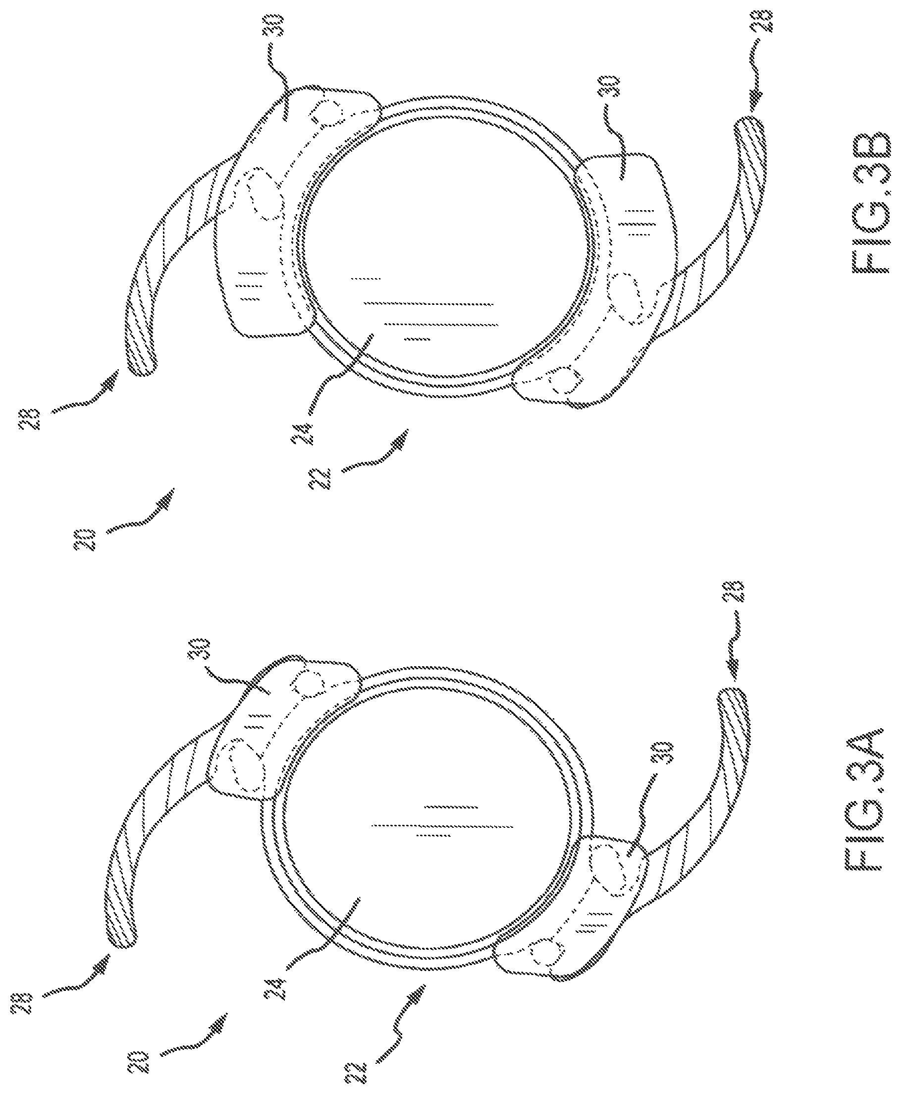 Patent US11771592 Figure 2 – Stabilized intraocular drug delivery systems and methods of use