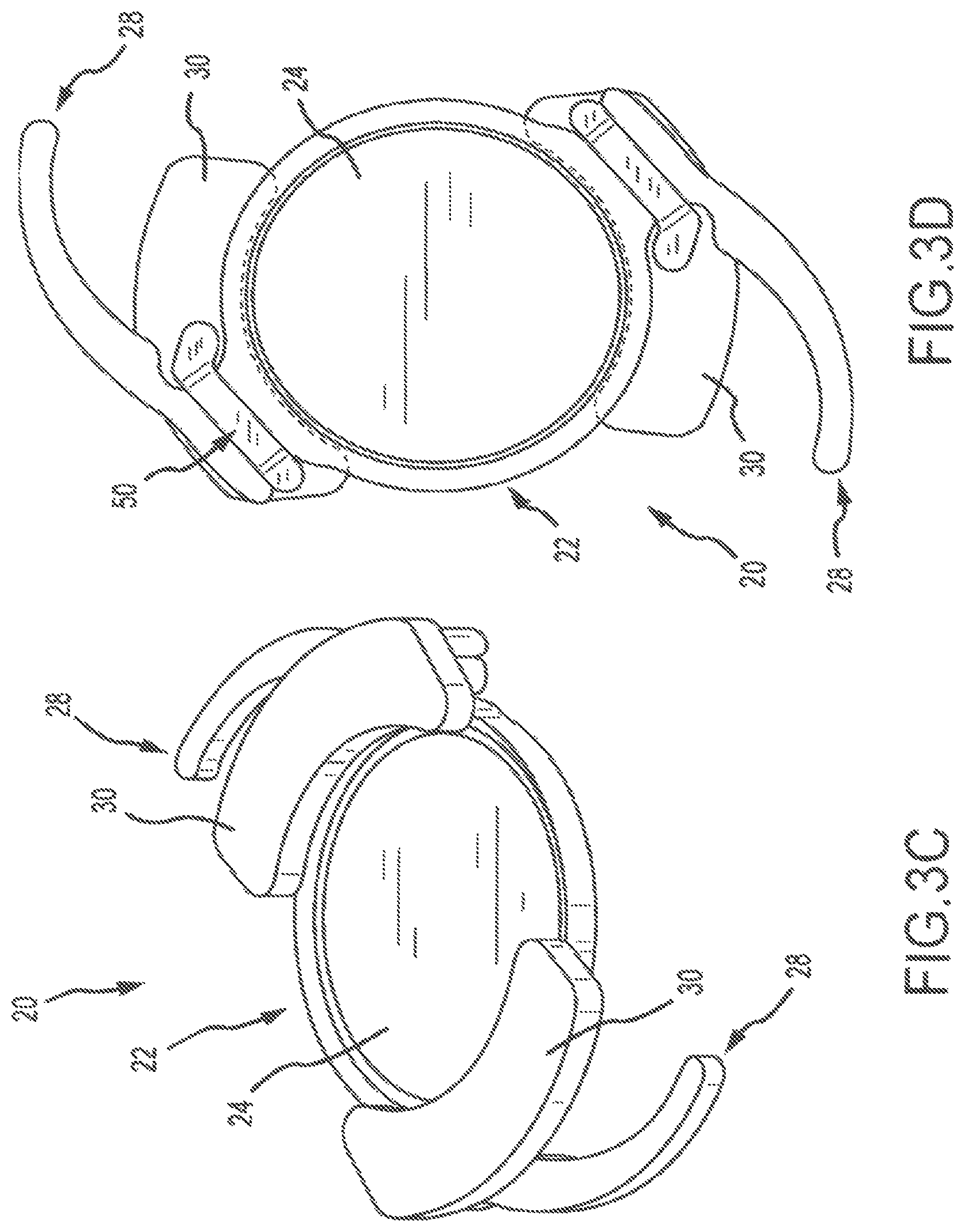 Patent US11771592 Figure 3 – Stabilized intraocular drug delivery systems and methods of use