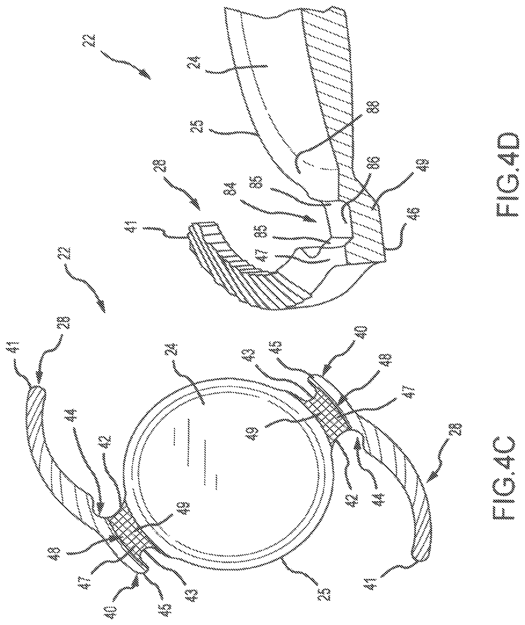 Patent US11771592 Figure 5 – Stabilized intraocular drug delivery systems and methods of use