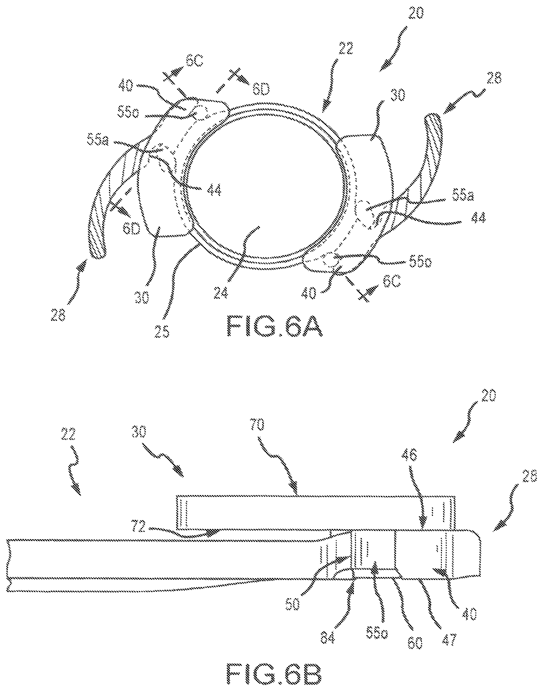 Patent US11771592 Figure 8 – Stabilized intraocular drug delivery systems and methods of use