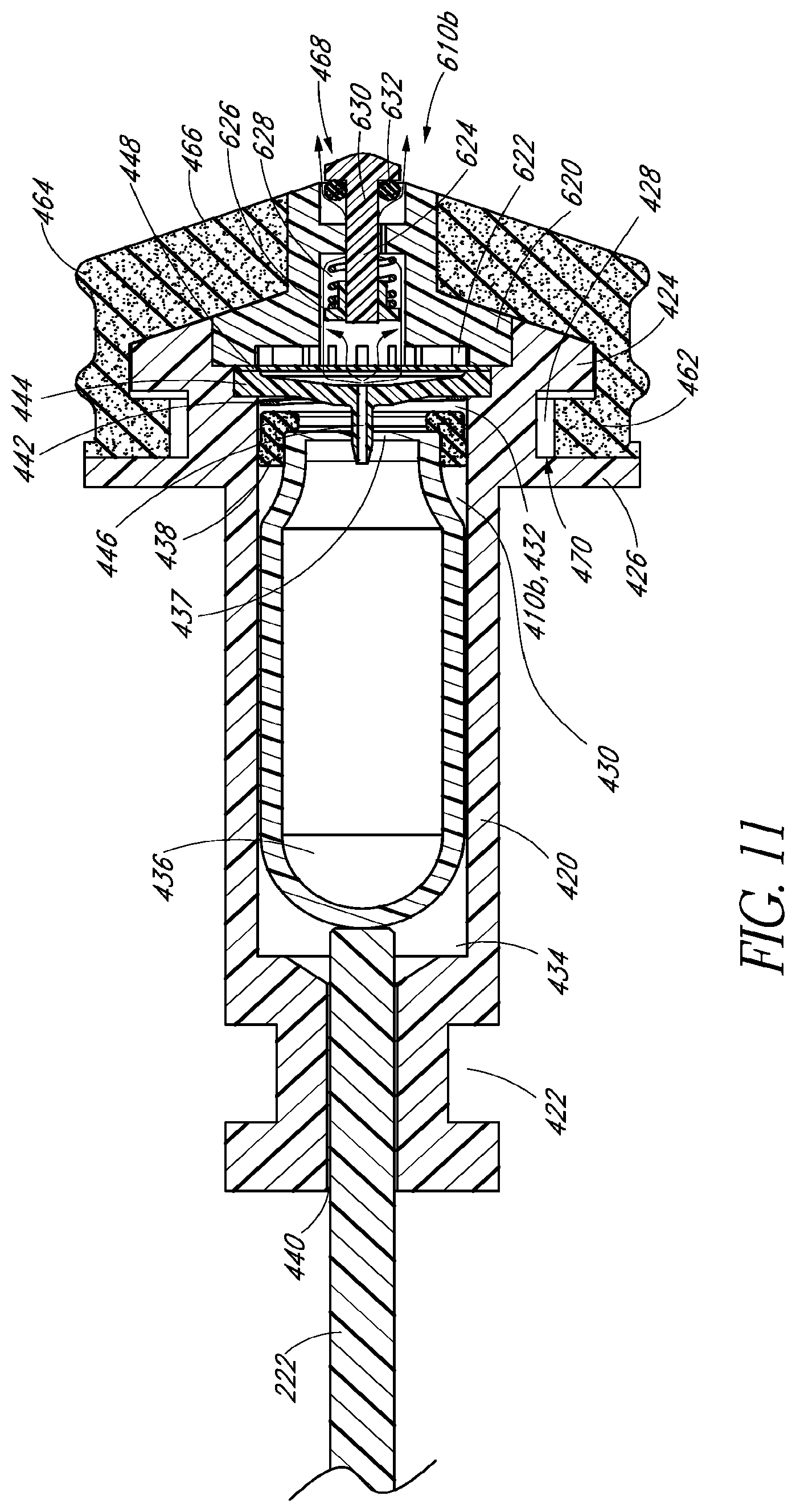 Patent US11771593 Figure 13 – Intraocular gas injector