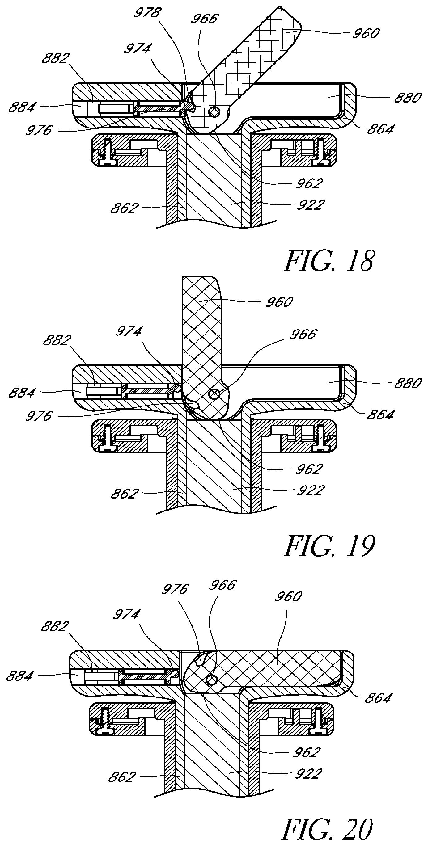 Patent US11771593 Figure 20 – Intraocular gas injector