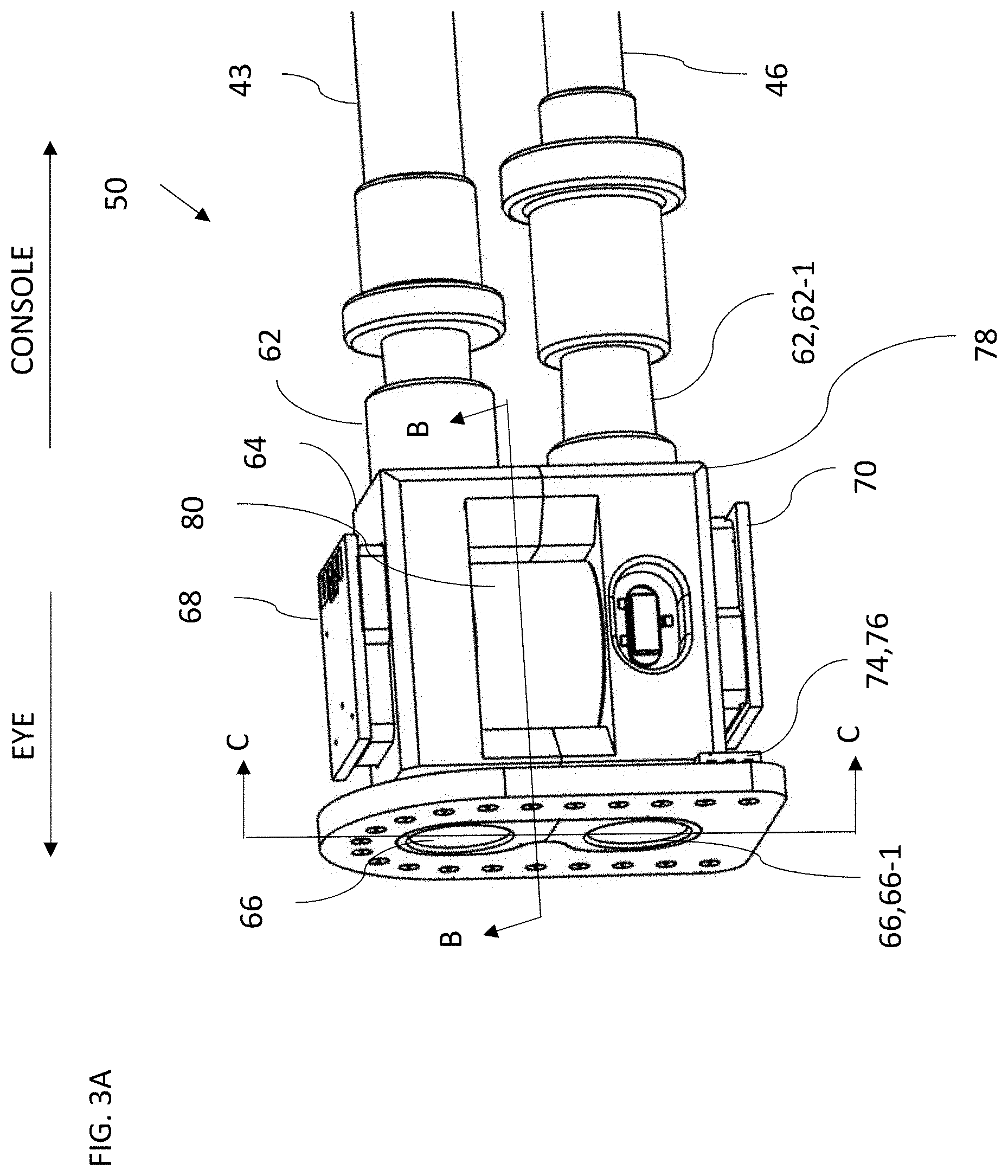 Patent US11771594 Figure 3 – Controlling intraocular pressure during phacoemulsification procedure