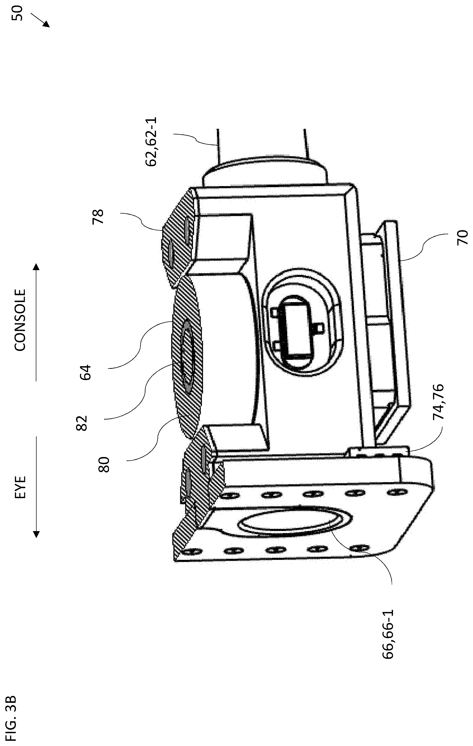 Patent US11771594 Figure 4 – Controlling intraocular pressure during phacoemulsification procedure