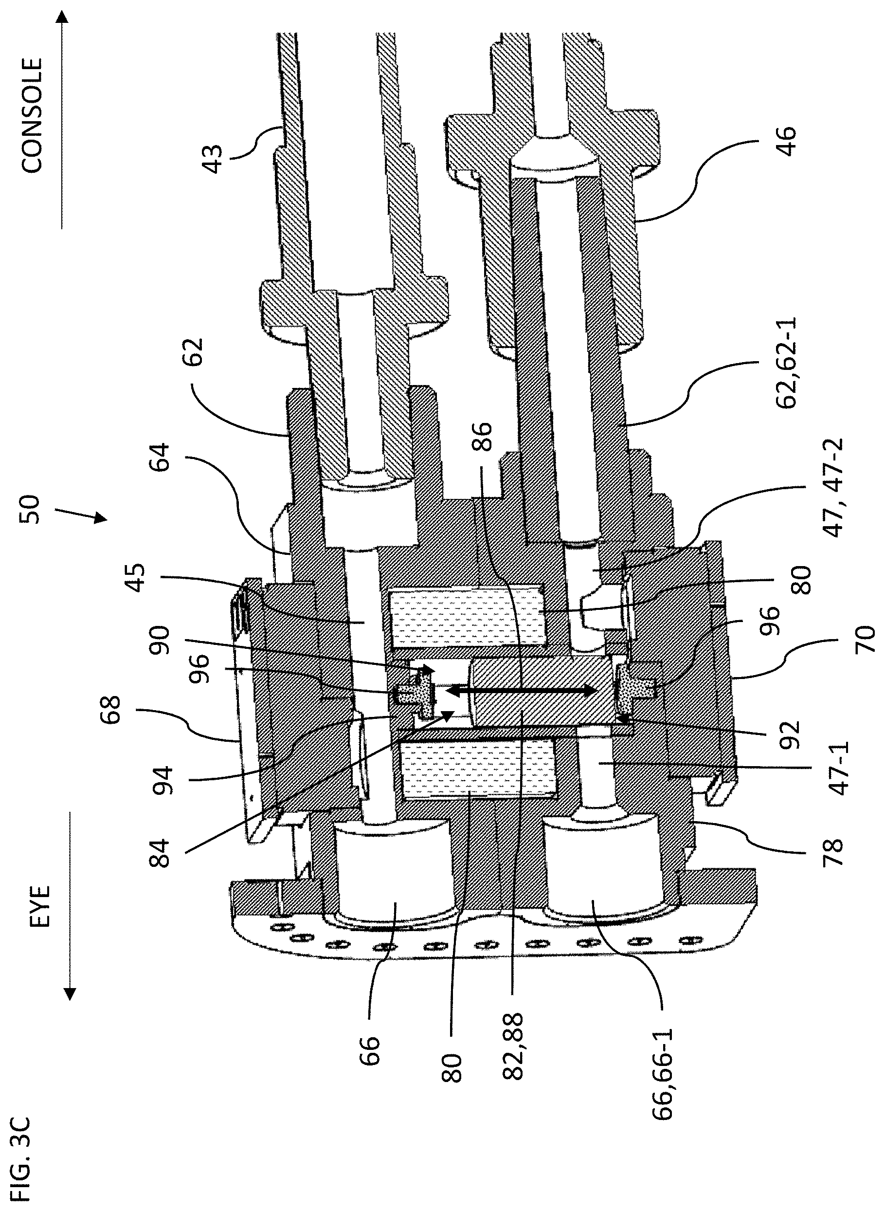 Patent US11771594 Figure 5 – Controlling intraocular pressure during phacoemulsification procedure