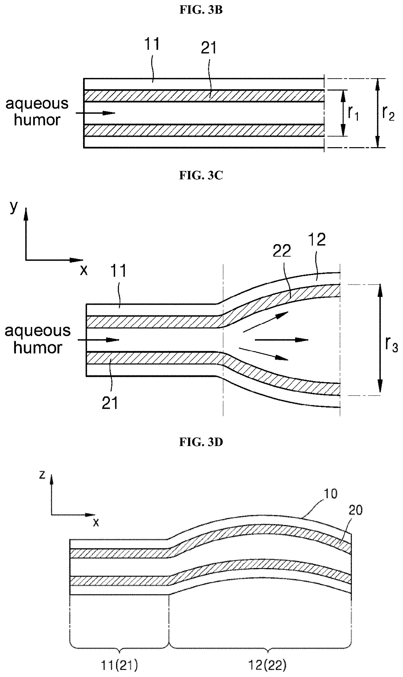 Patent US11771595 Figure 3 – Implant device for eye disease for adjusting intraocular pressure