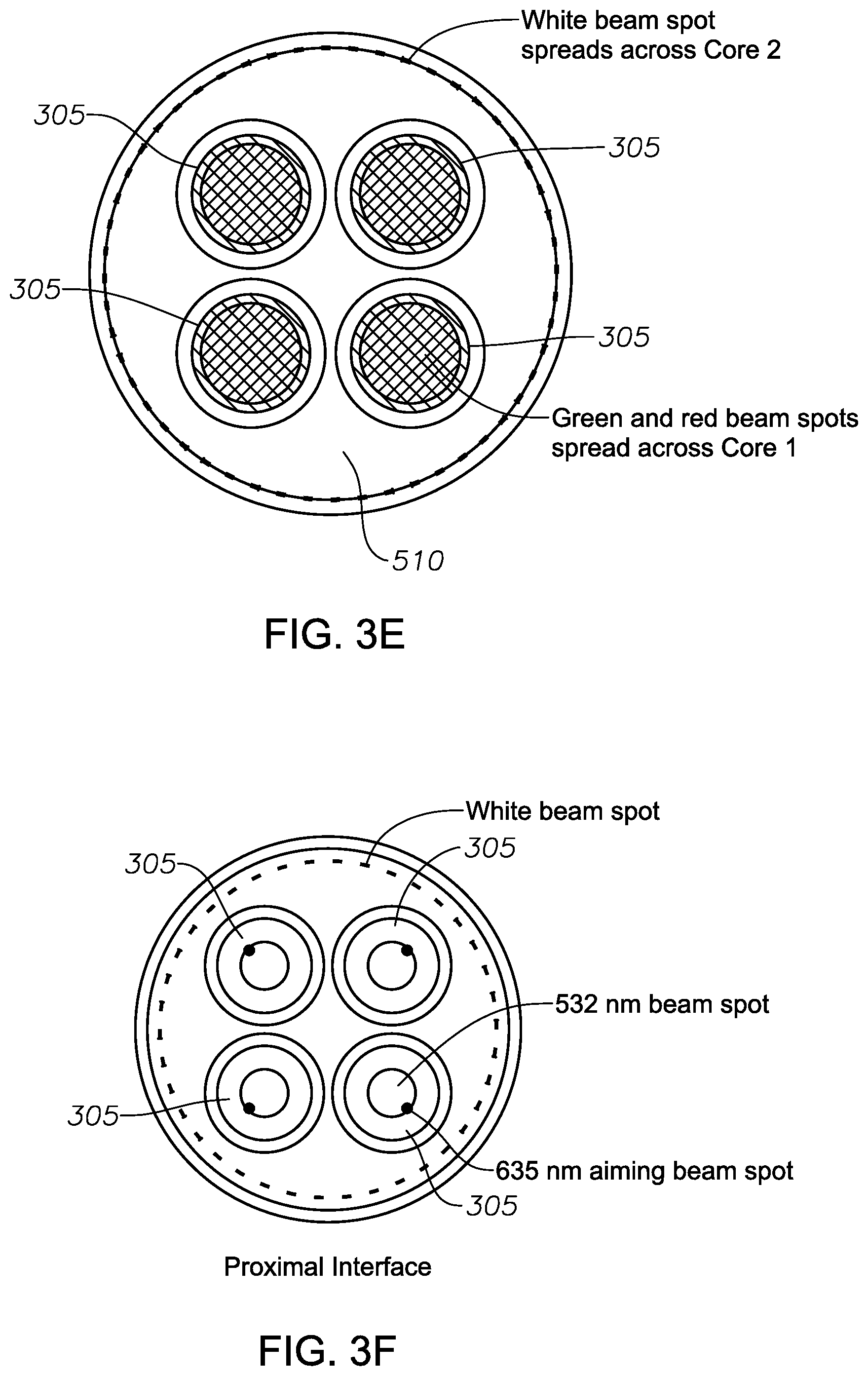 Patent US11771597 Figure 6 – Multiple-input-coupled illuminated multi-spot laser probe