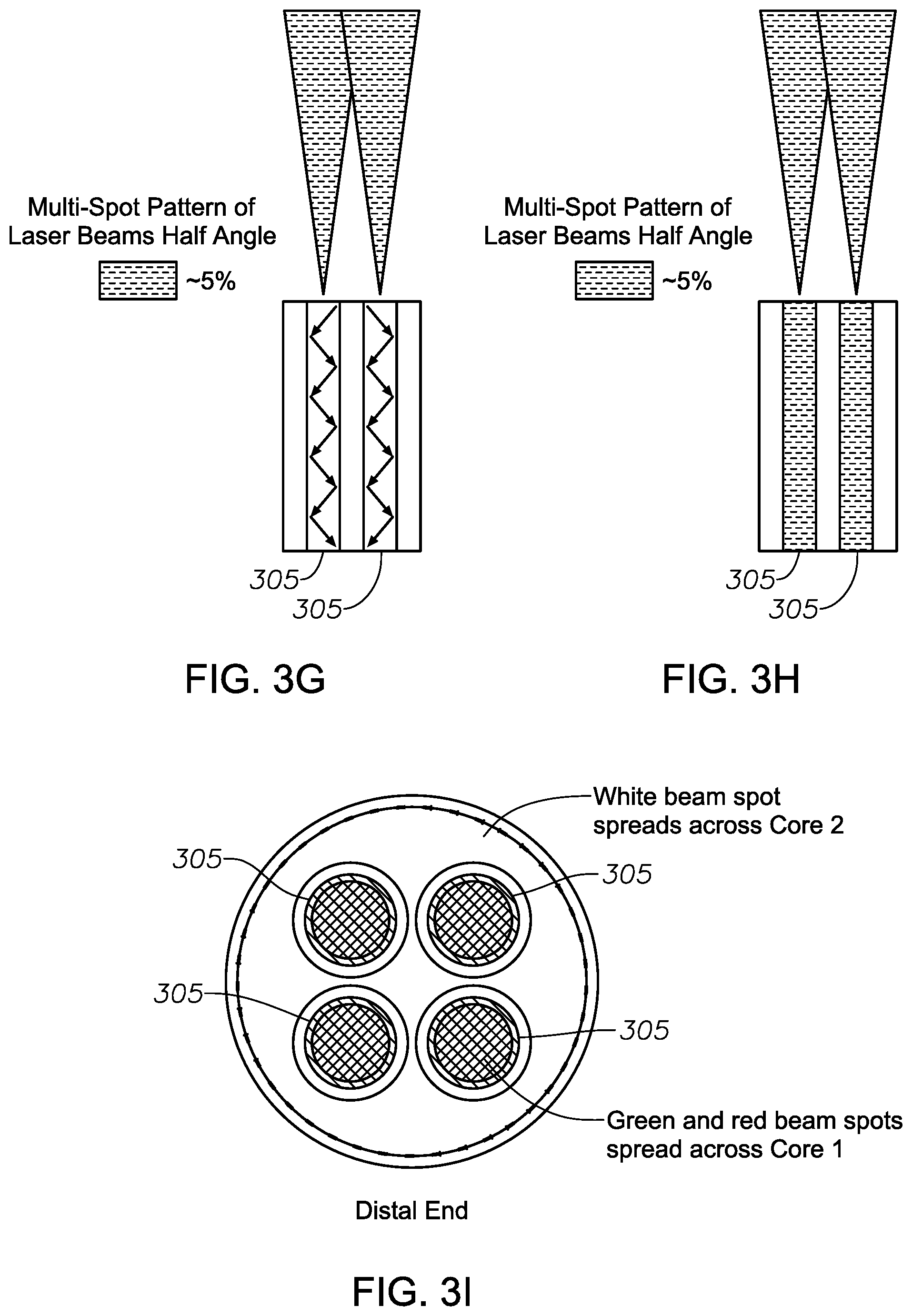 Patent US11771597 Figure 7 – Multiple-input-coupled illuminated multi-spot laser probe