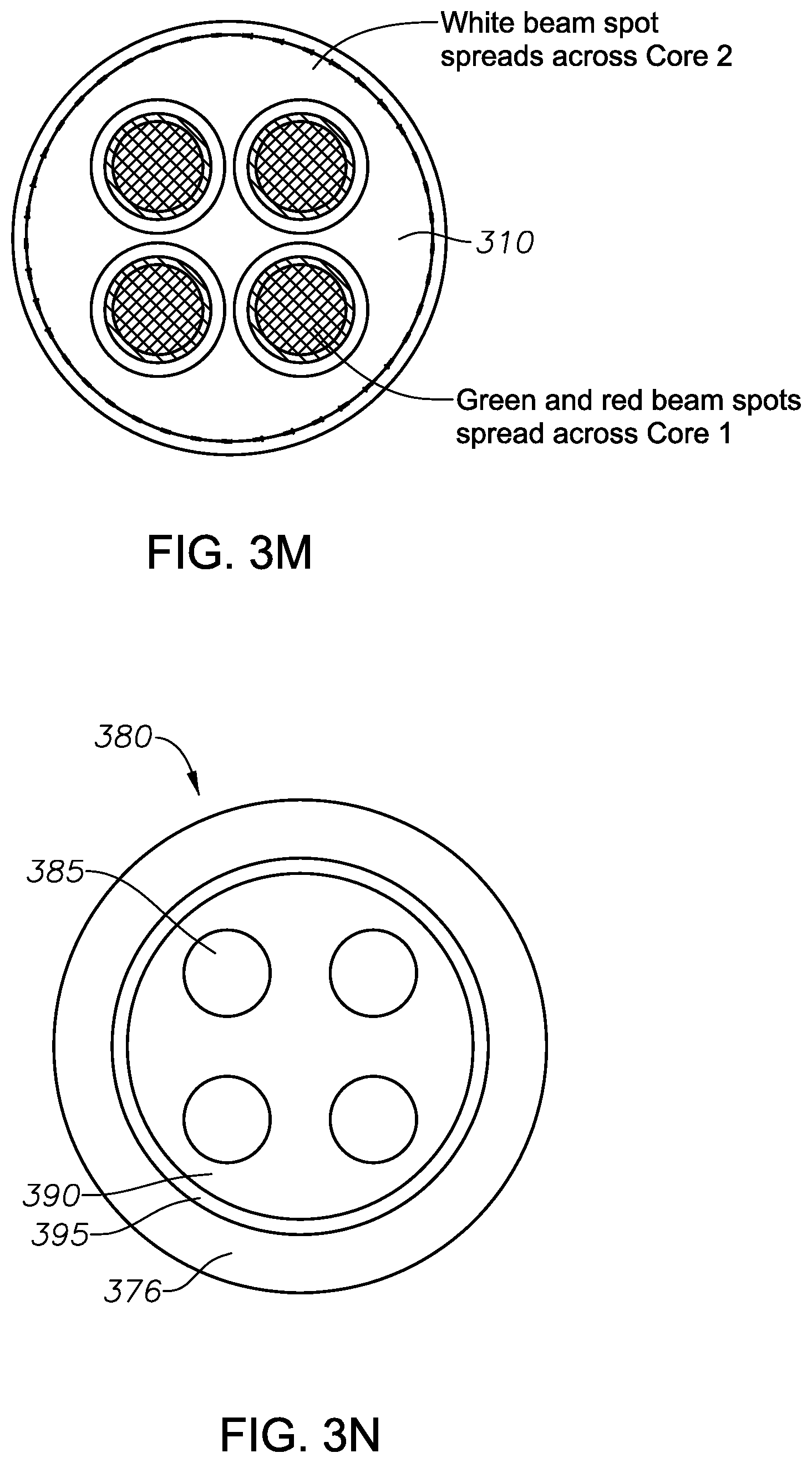 Patent US11771597 Figure 9 – Multiple-input-coupled illuminated multi-spot laser probe