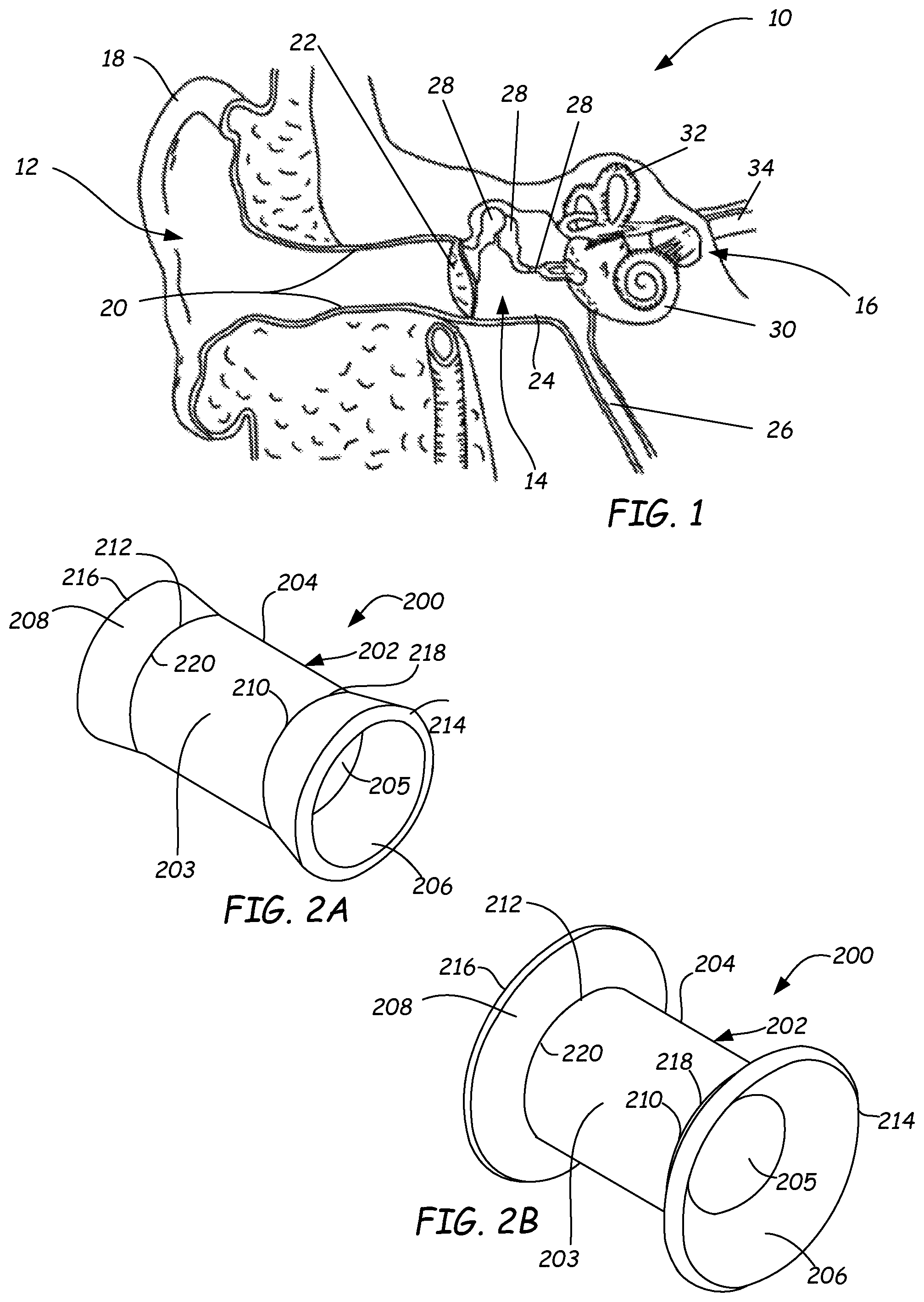 Patent US11771598 Figure 1 – Ventilation device and insertion system therefor