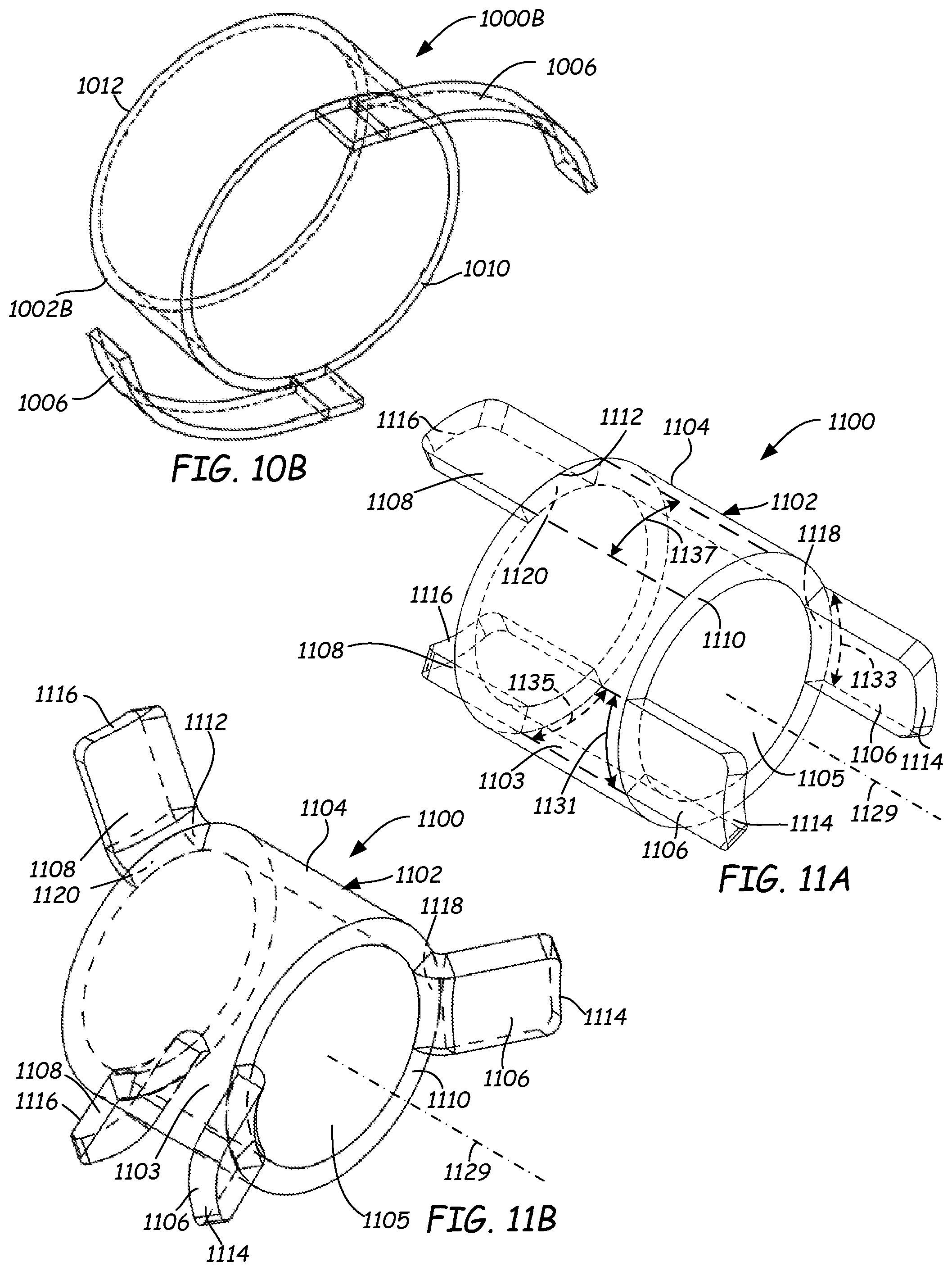 Patent US11771598 Figure 9 – Ventilation device and insertion system therefor