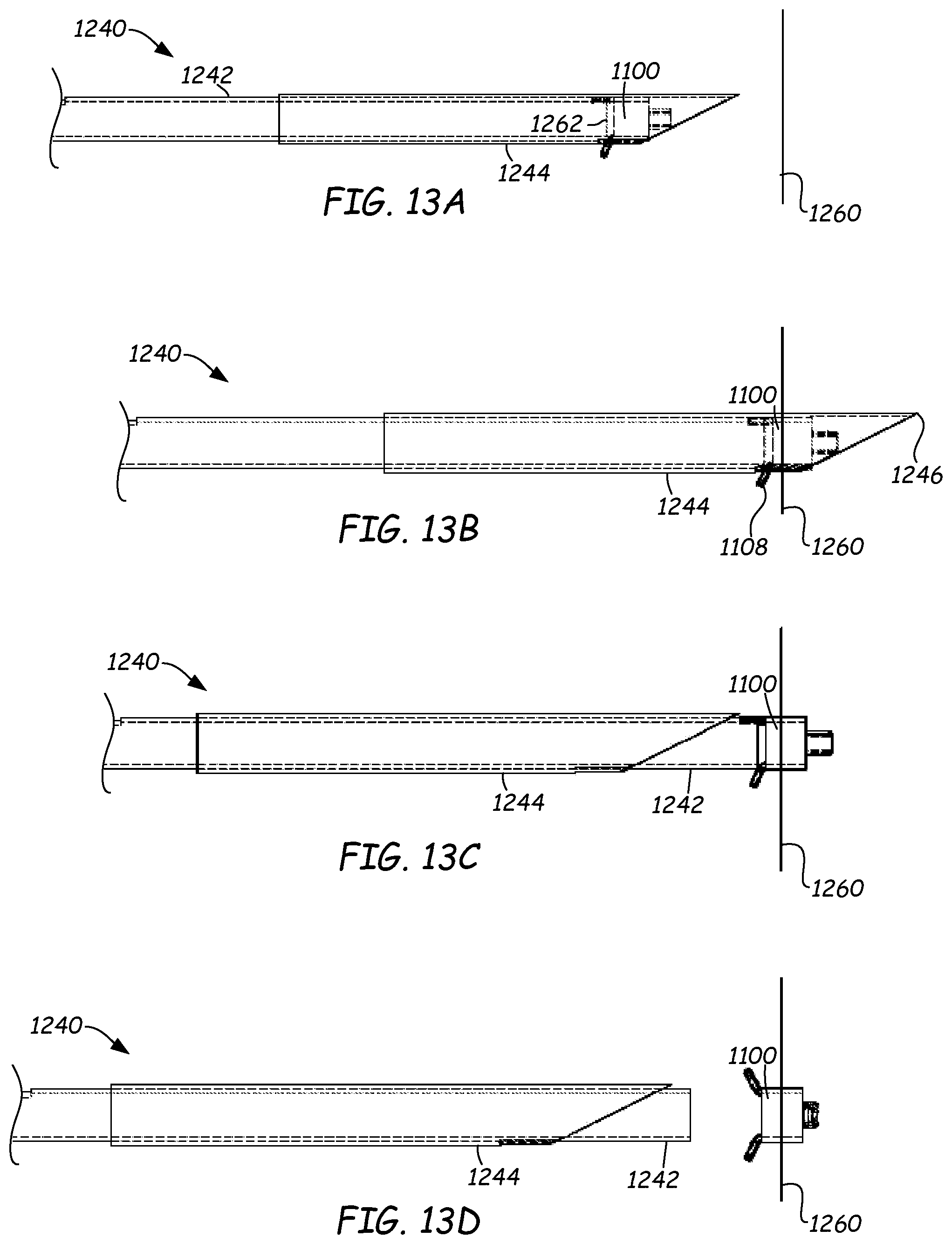 Patent US11771598 Figure 14 – Ventilation device and insertion system therefor