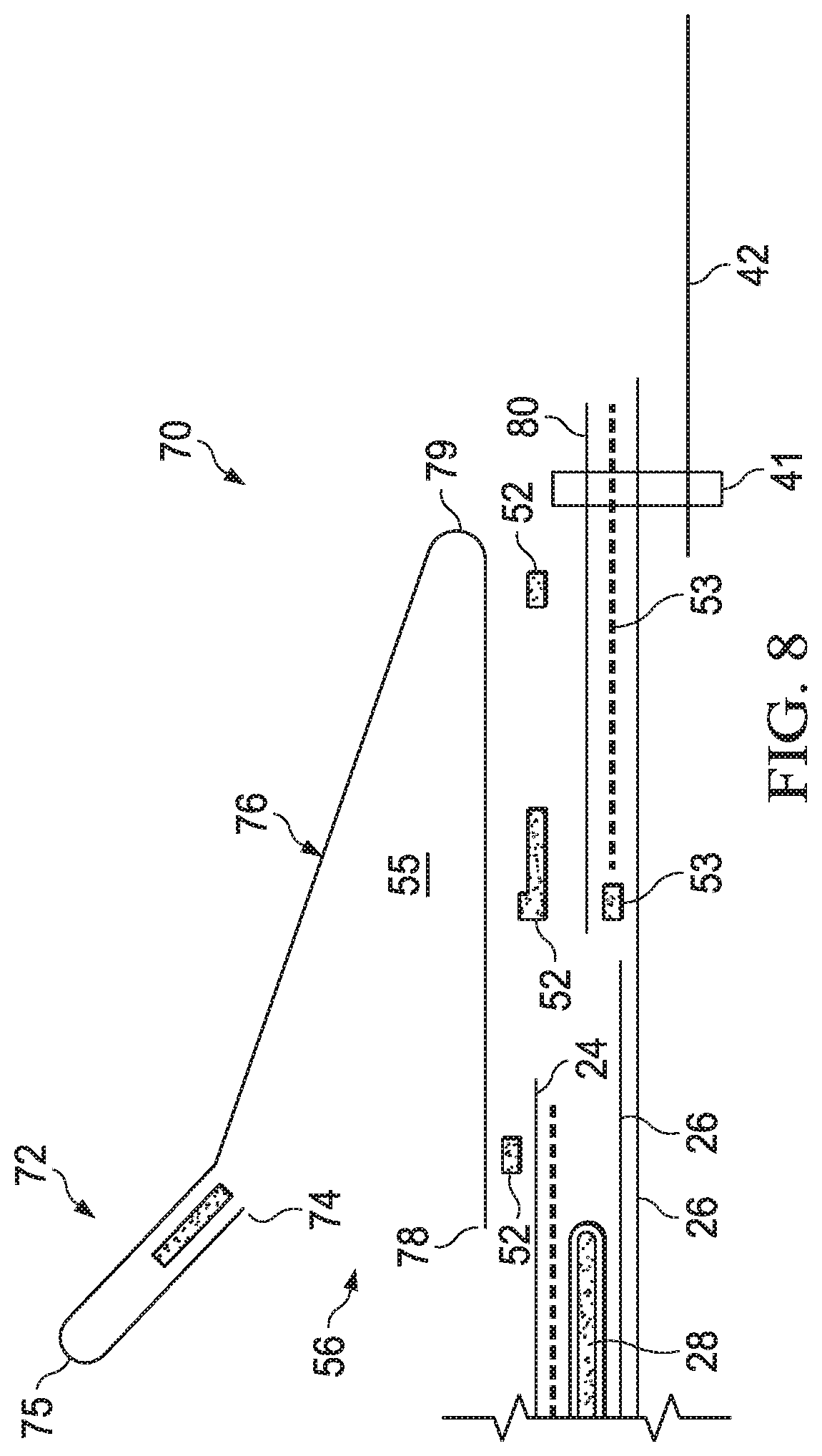 Patent US11771601 Figure 14 – Absorbent article with elasticized region