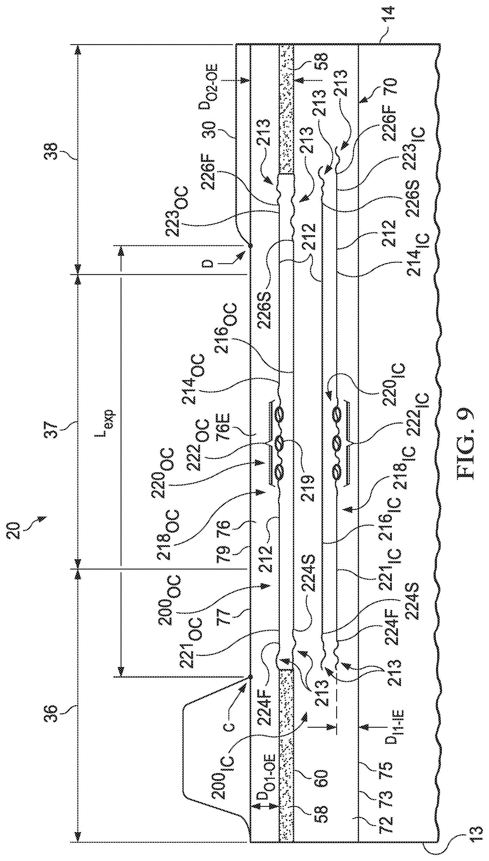 Patent US11771601 Figure 15 – Absorbent article with elasticized region