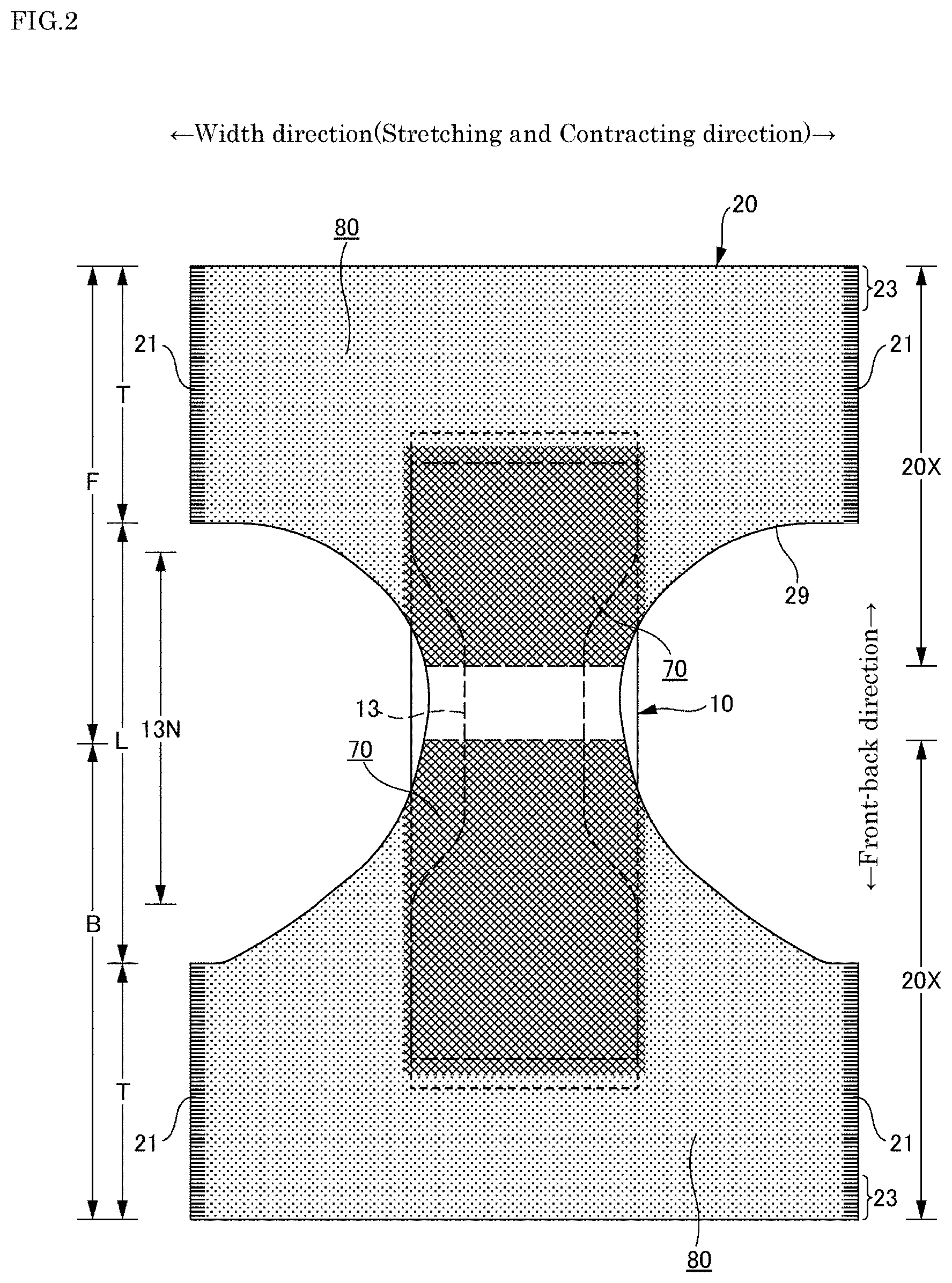 Patent US11771602 Figure 2 – Absorbent article and method for manufacturing same
